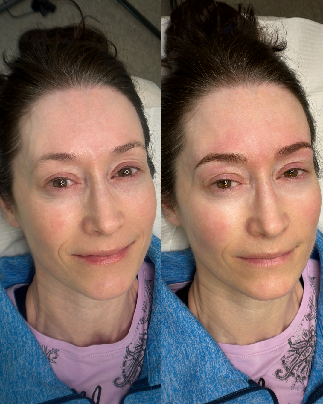 Before and After Machine Nano Brows by Kellee