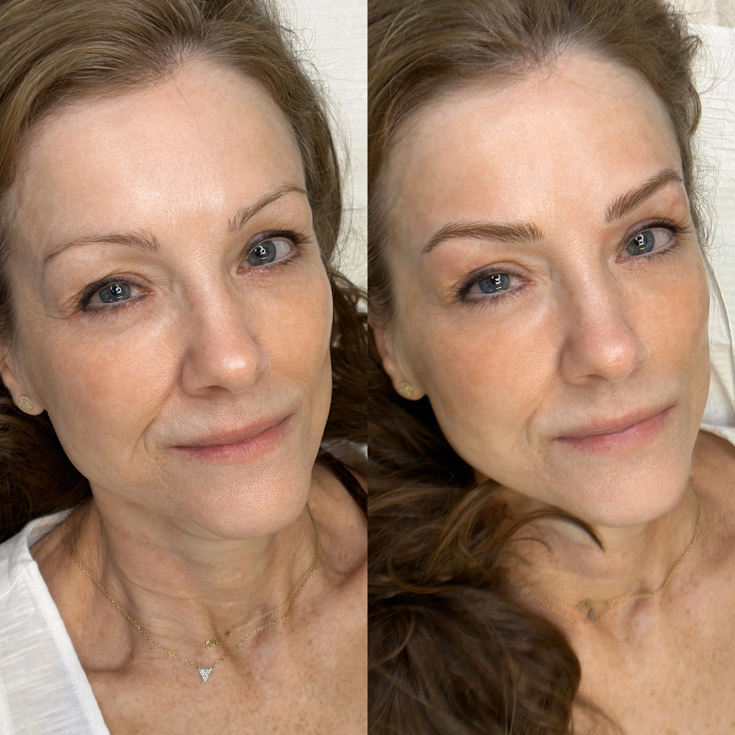 Before and After Machine Nano Brows by Kellee