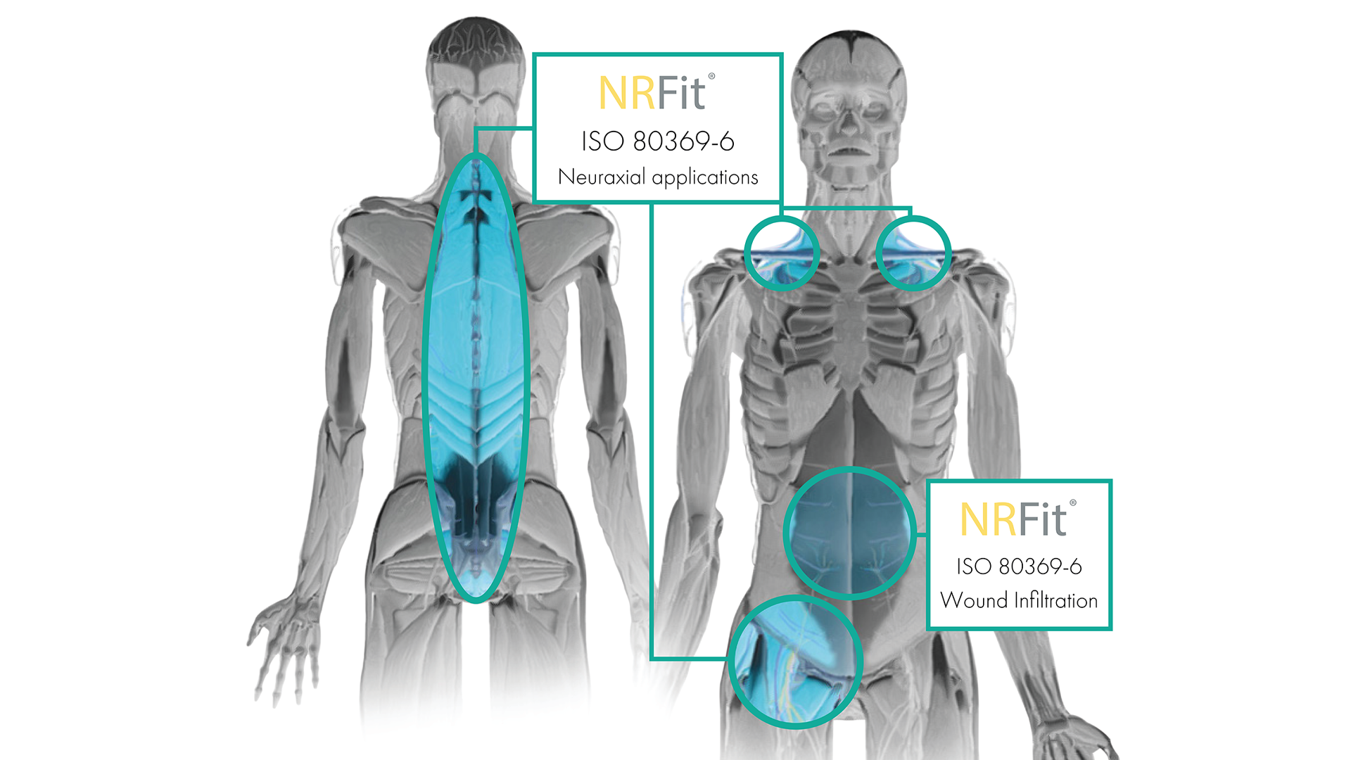 What Is NRFit®? A Simple Guide for Anaesthesia Professionals