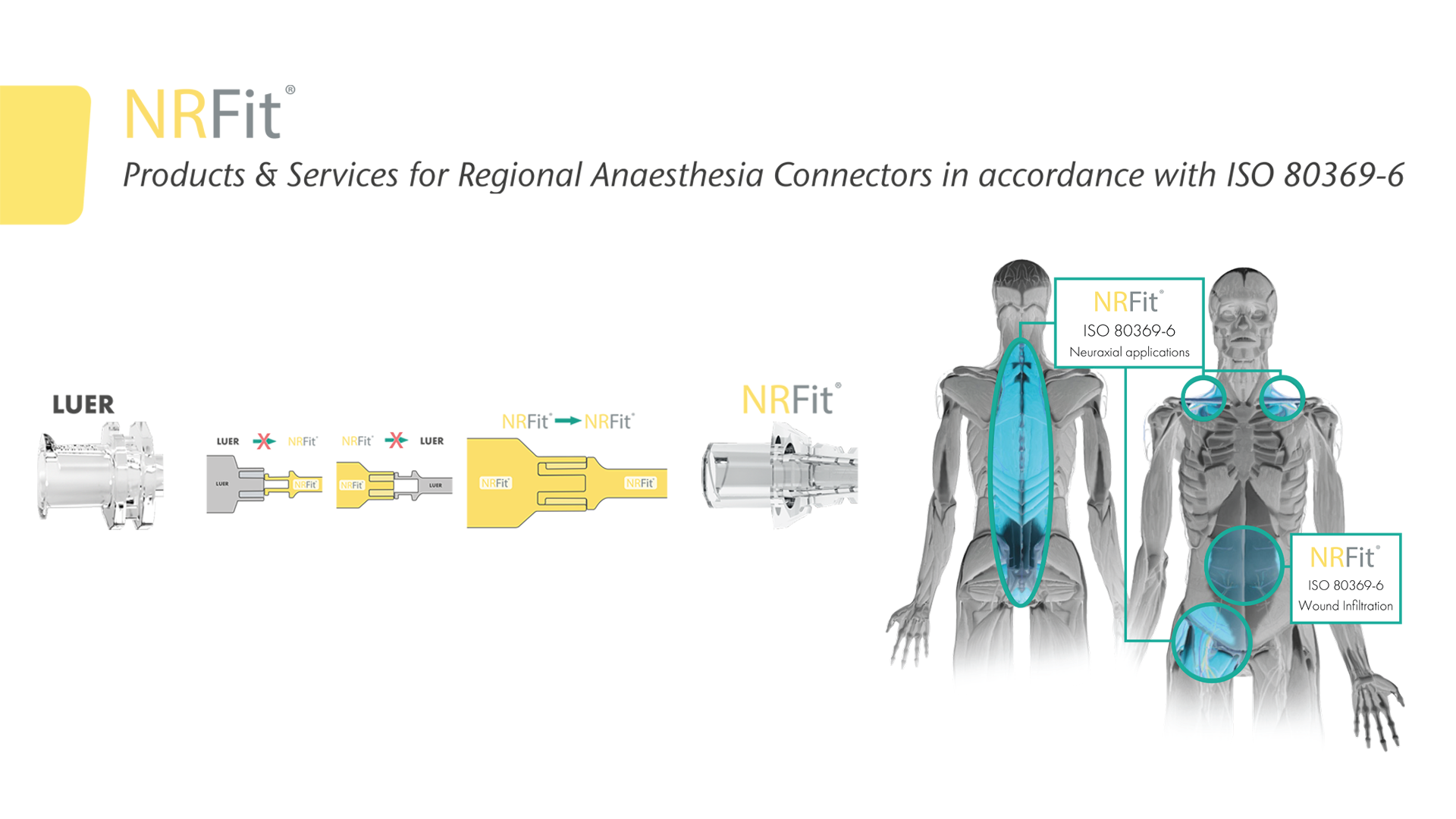 NRFit: Redefining Safety in Neuraxial and Regional Anaesthesia