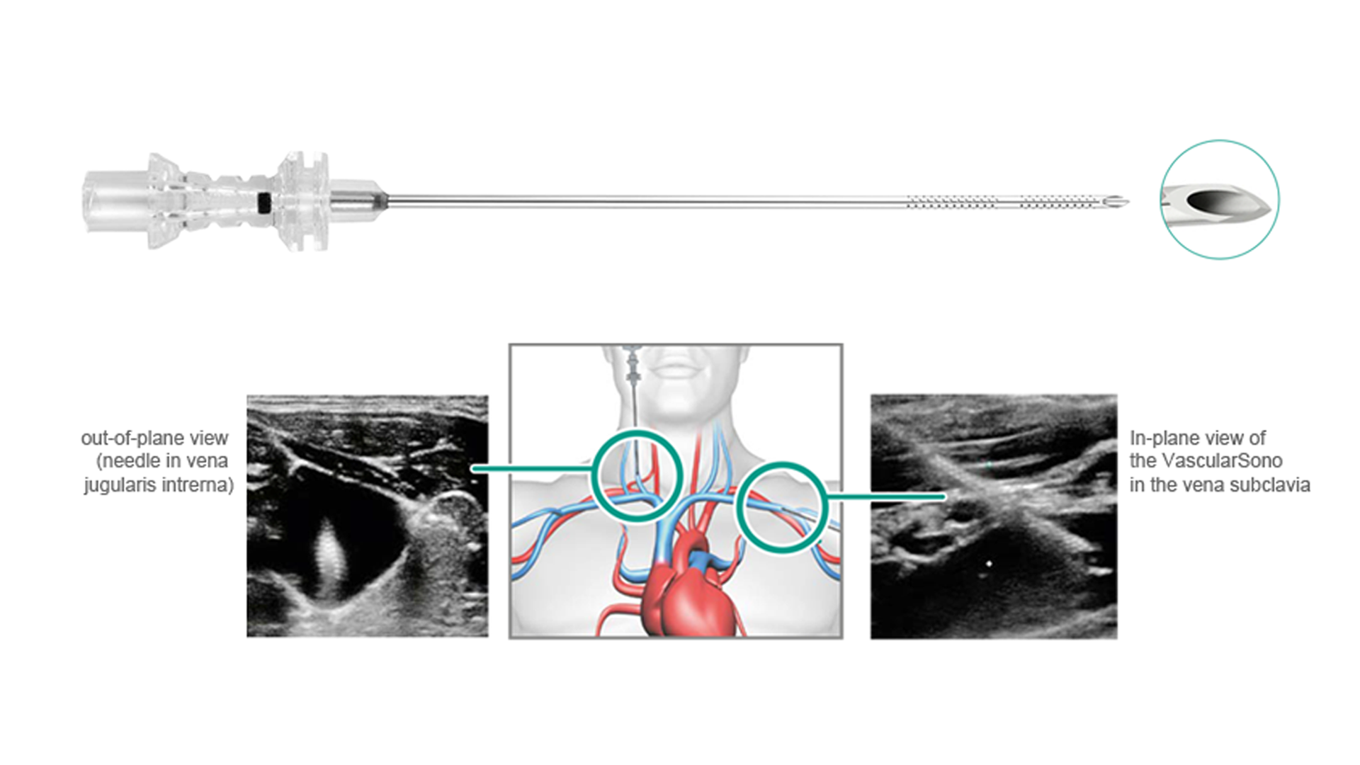 Vascular Sono Needle