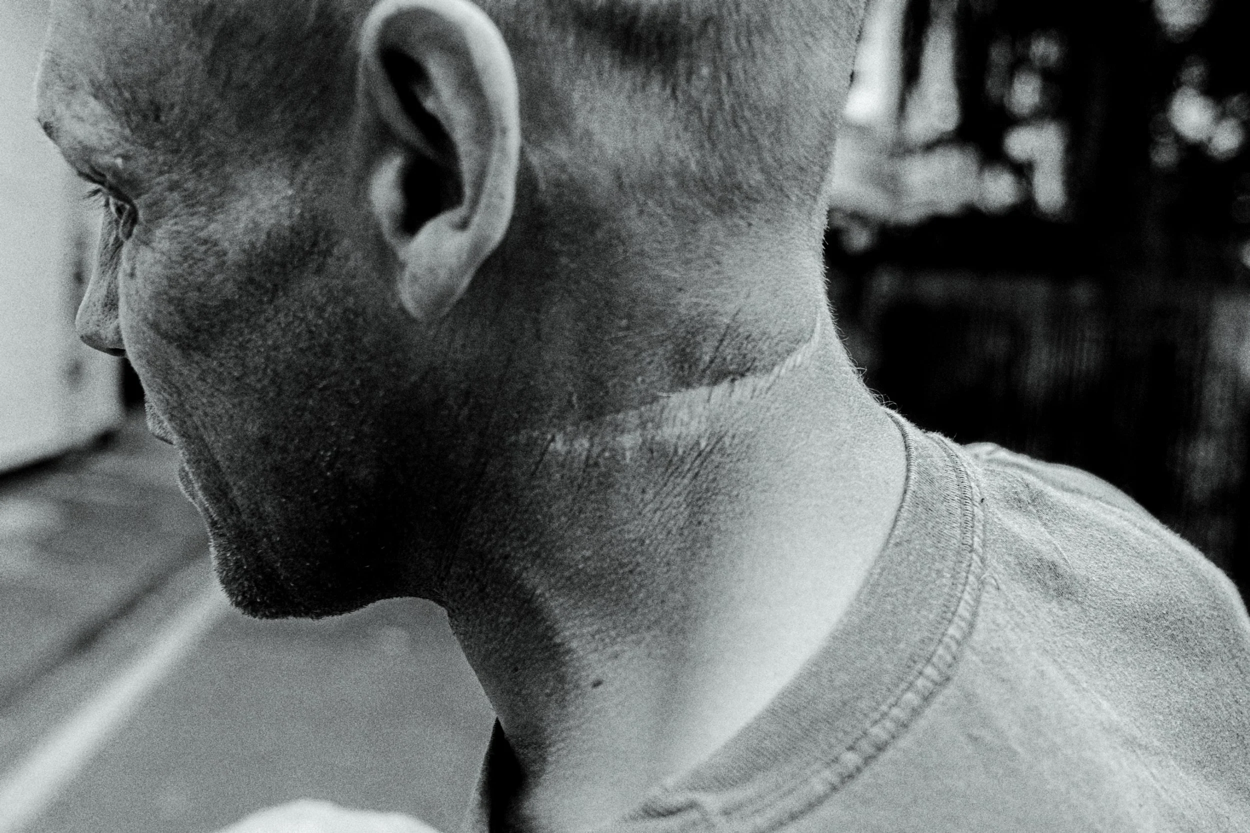 Stevie-neck-1.jpg