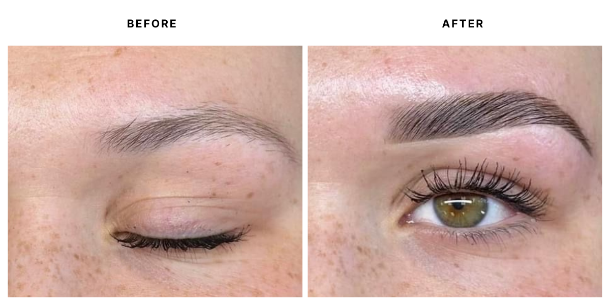  Before and after aesthetic treatment results at Laser &amp; Skin Medical in Edgewater, Miami 