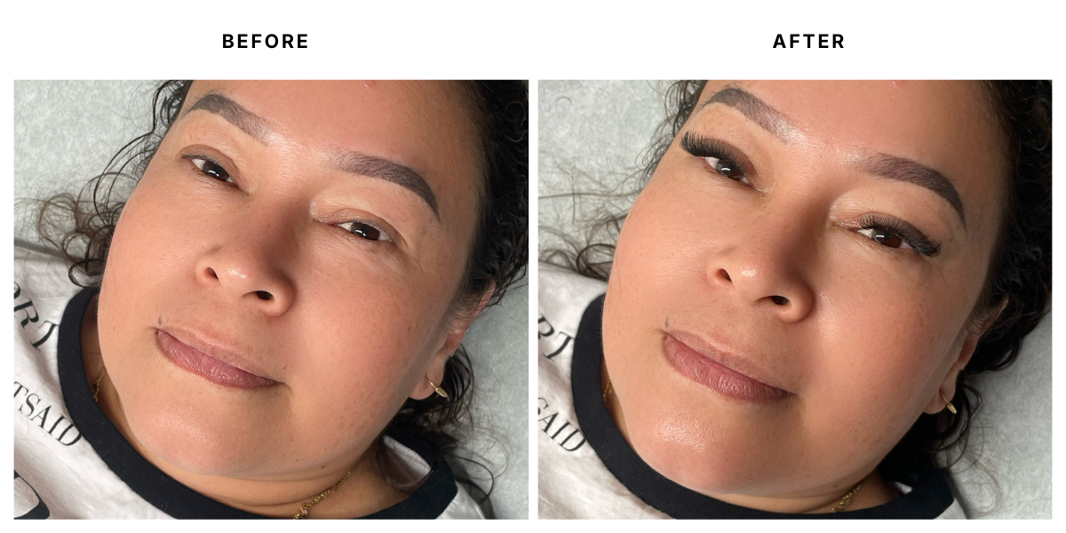  Before and after aesthetic treatment results at Laser &amp; Skin Medical in Edgewater, Miami 