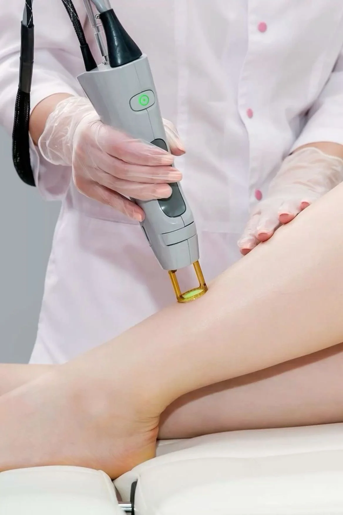 Advanced laser hair removal treatment using medical-grade technology at Laser & Skin Medical in Edgewater, Miami