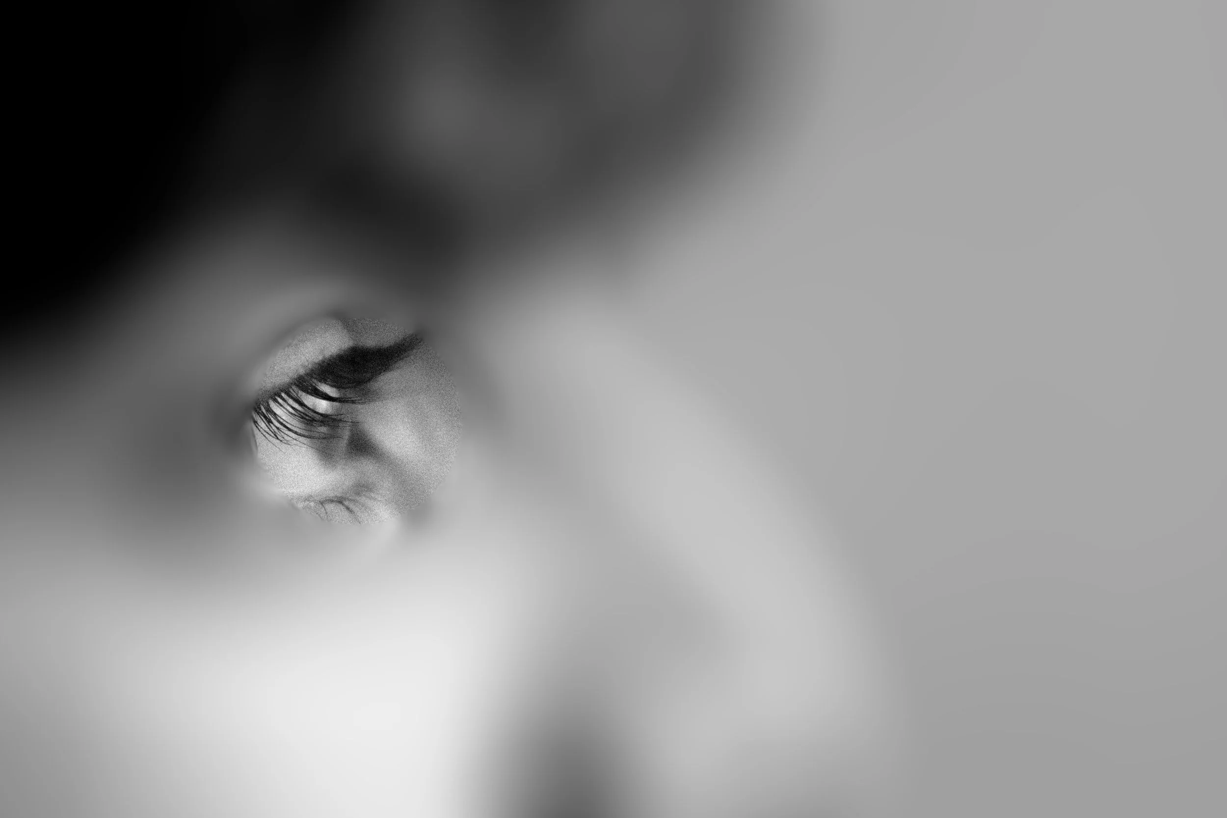 Eye Pupil Seclusion -Aaryan.jpg