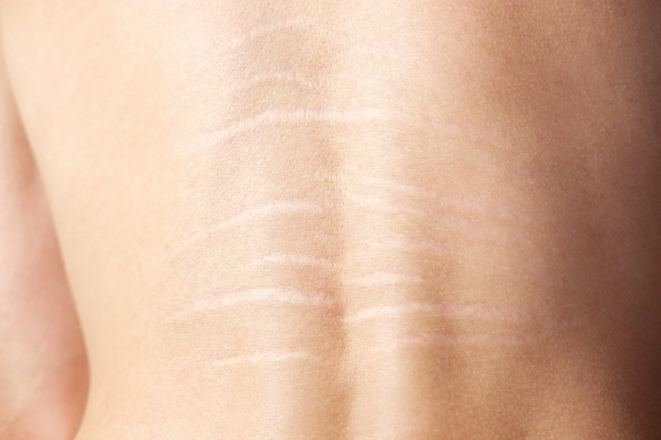 Close-up of human skin, showing natural texture and pores.