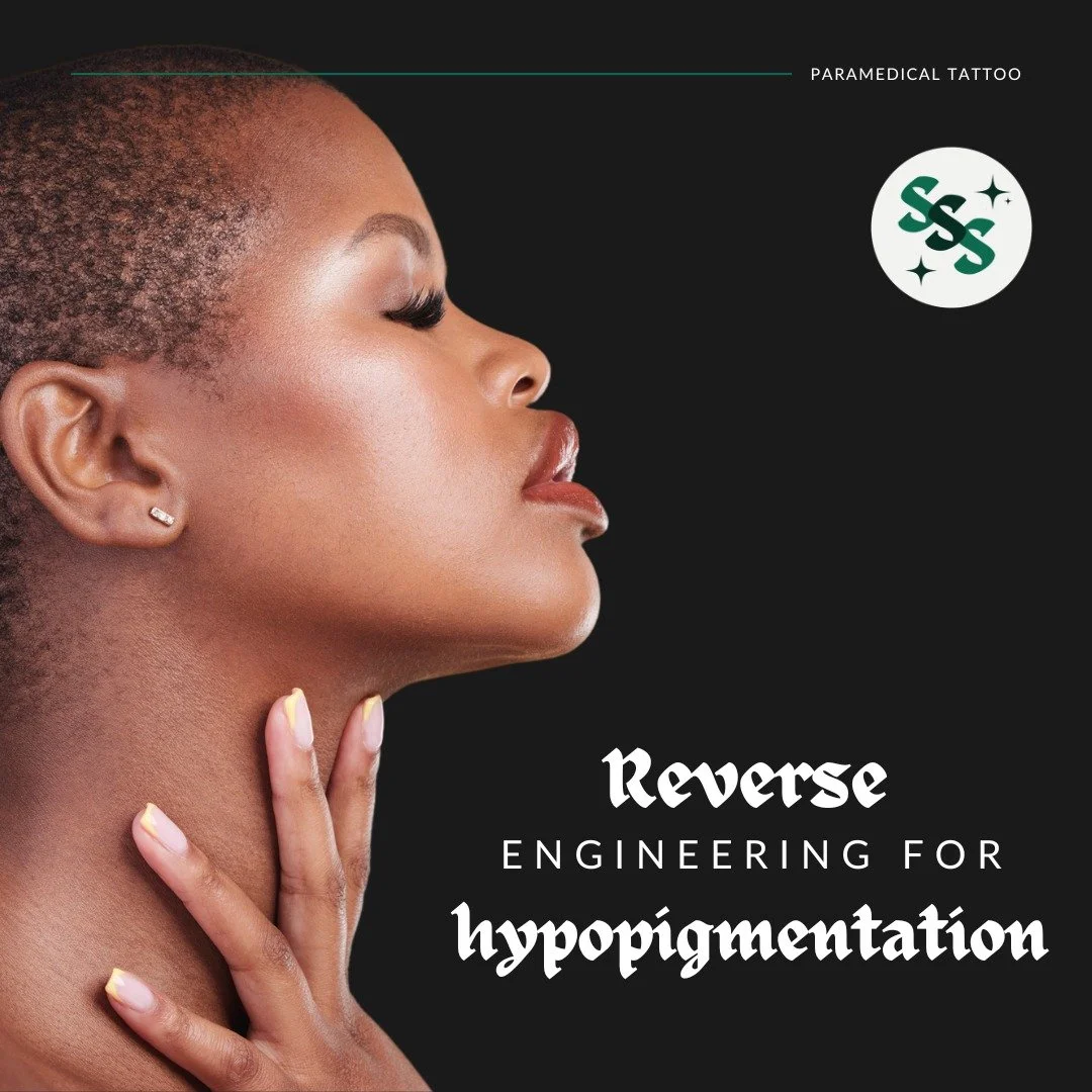 Hypopigmentation happens when the skin loses its natural colour &mdash; through scarring, burns, vitiligo, or skin conditions. Camouflage tattooing works by implanting custom-matched pigments to restore the colour your skin has lost, blending the aff