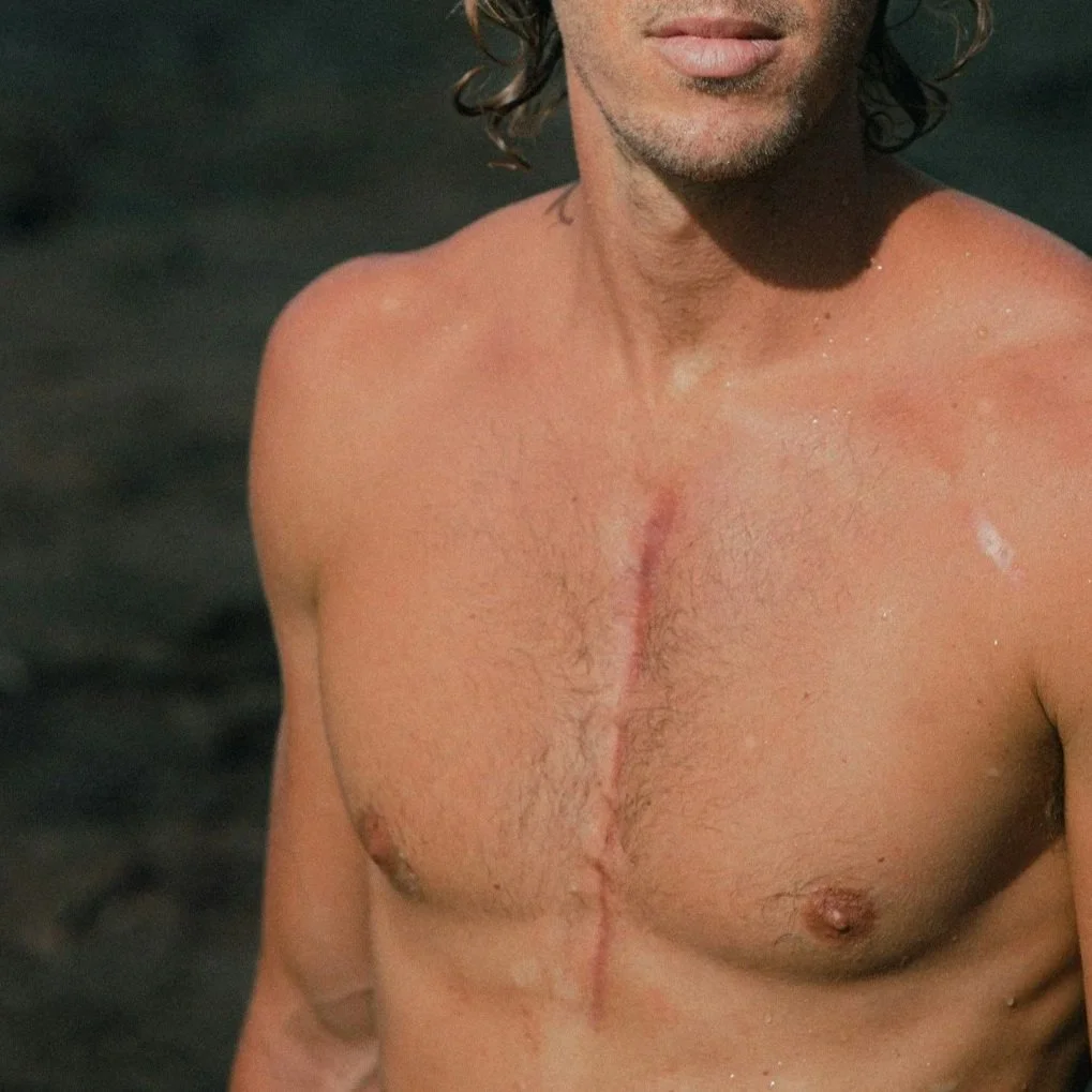 Close-up of a shirtless man with a long, prominent scar running down the middle of his chest.