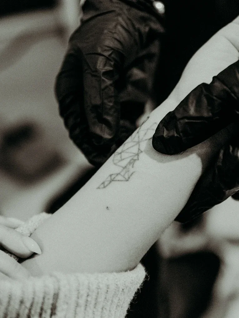 Close-up of a person wearing black gloves, assessing tattoo for laser removal on persons fore-arm.