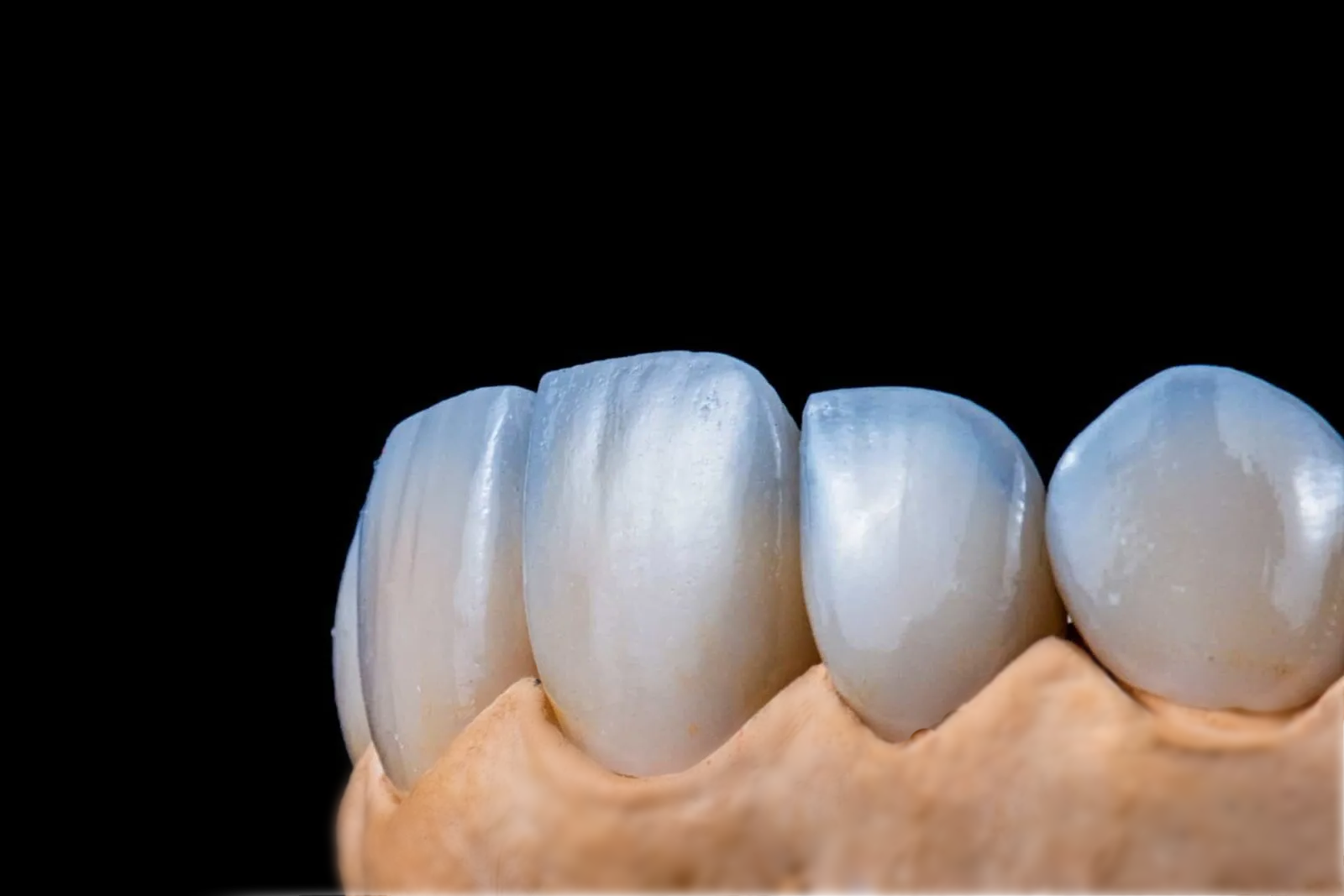 PDA_Layered_Zirconia