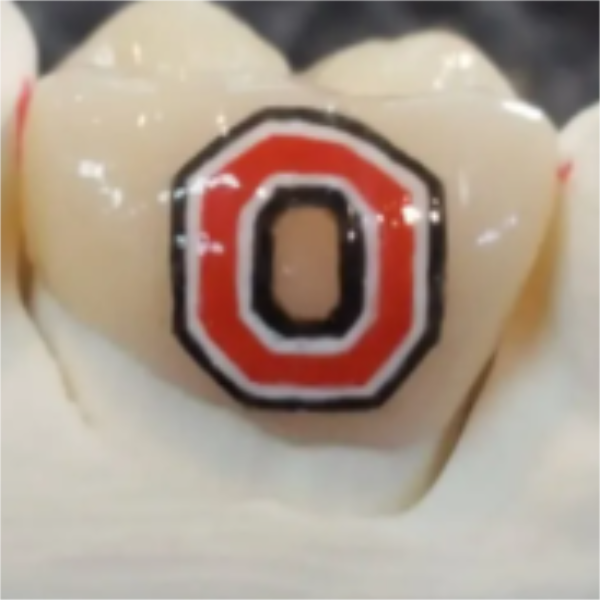 Close-up of a tooth with an edible decoration featuring the Ohio State University logo.
