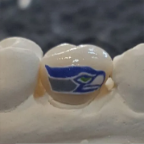 Close-up of a tooth with the Seattle Seahawks logo on it.