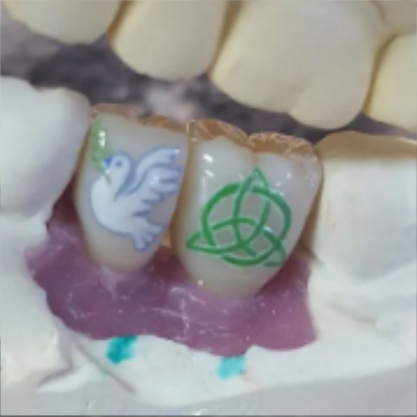 Close-up of a dental prosthetic showing two front teeth with decorative designs, one with a swan and the other with a green knot pattern.