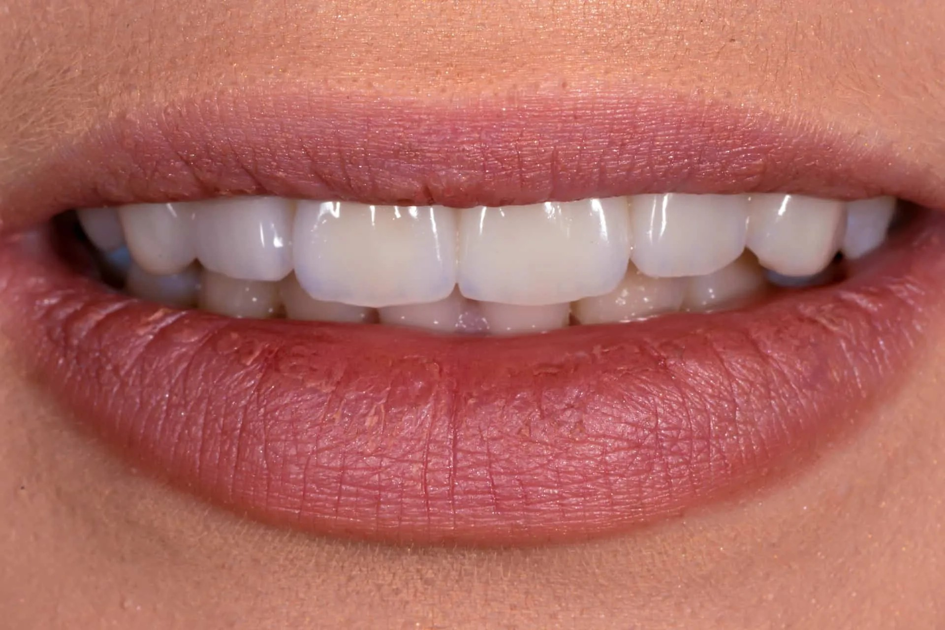 Close-up of smiling lips showing white teeth.