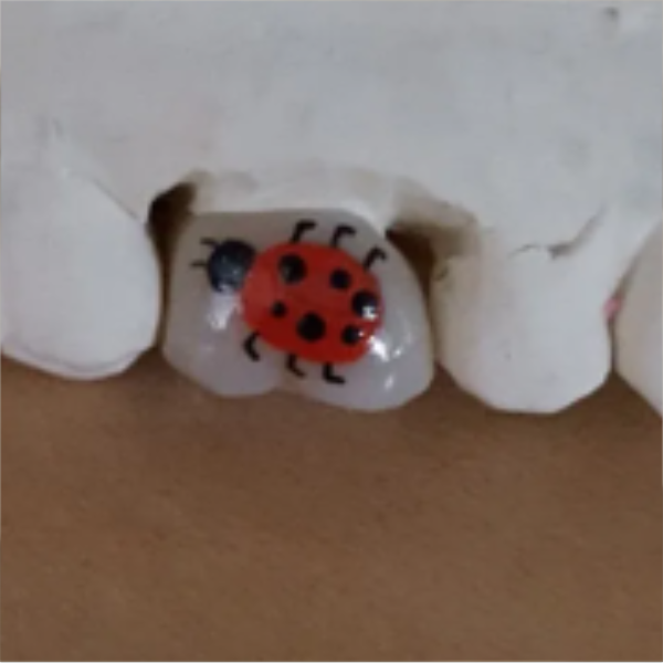 A close-up of teeth with a small red ladybug sticker on one tooth.