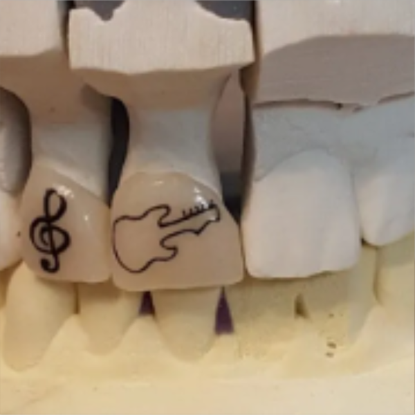 Close-up of wooden dental models with musical symbols and a guitar drawing on the front teeth.