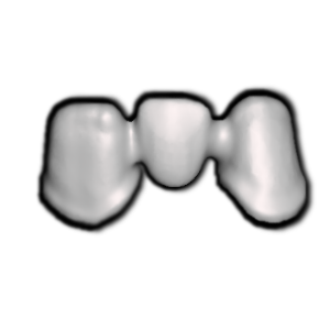 A close-up of a dental bridge or prosthetic teeth against a black background.