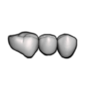 Close-up of three dental crowns or teeth on a black background.