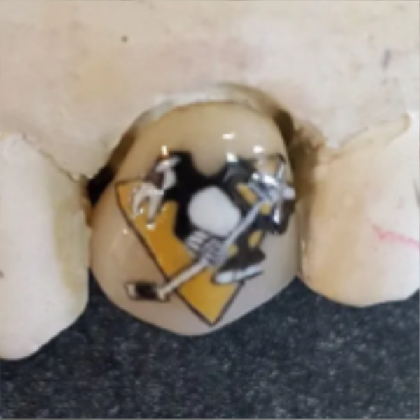 Close-up of a dental crown or cap on a tooth, featuring a painted or printed logo of a penguin holding a hockey stick, with a yellow background.