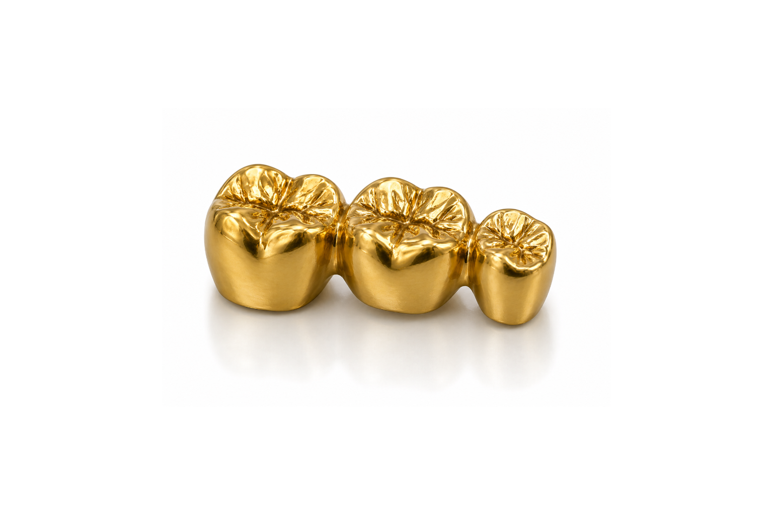 A gold dental crown or bridge with three tooth-shaped sections on a white background.