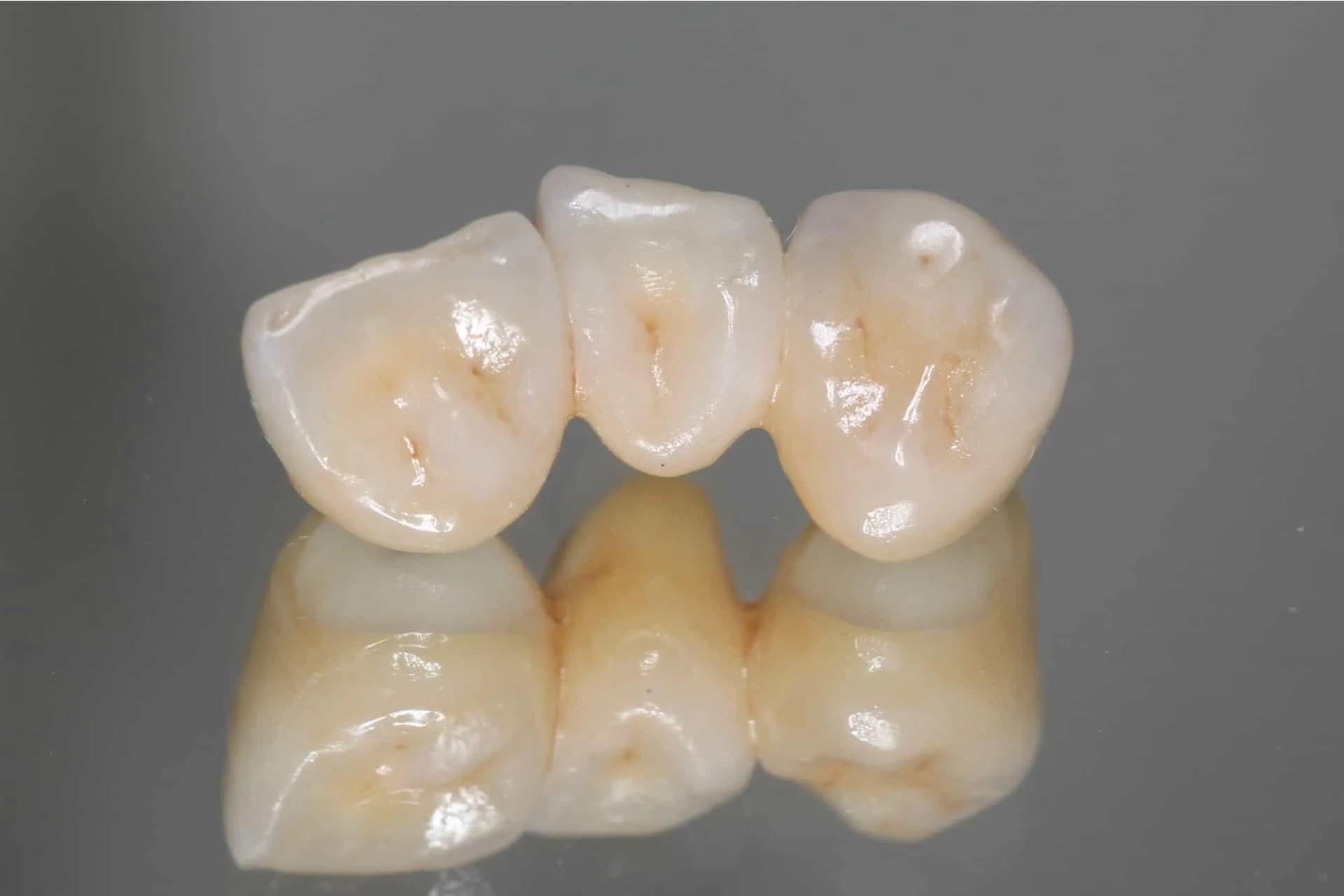 Close-up of three dental crowns, beige in color, reflecting on a shiny surface with a gray background.