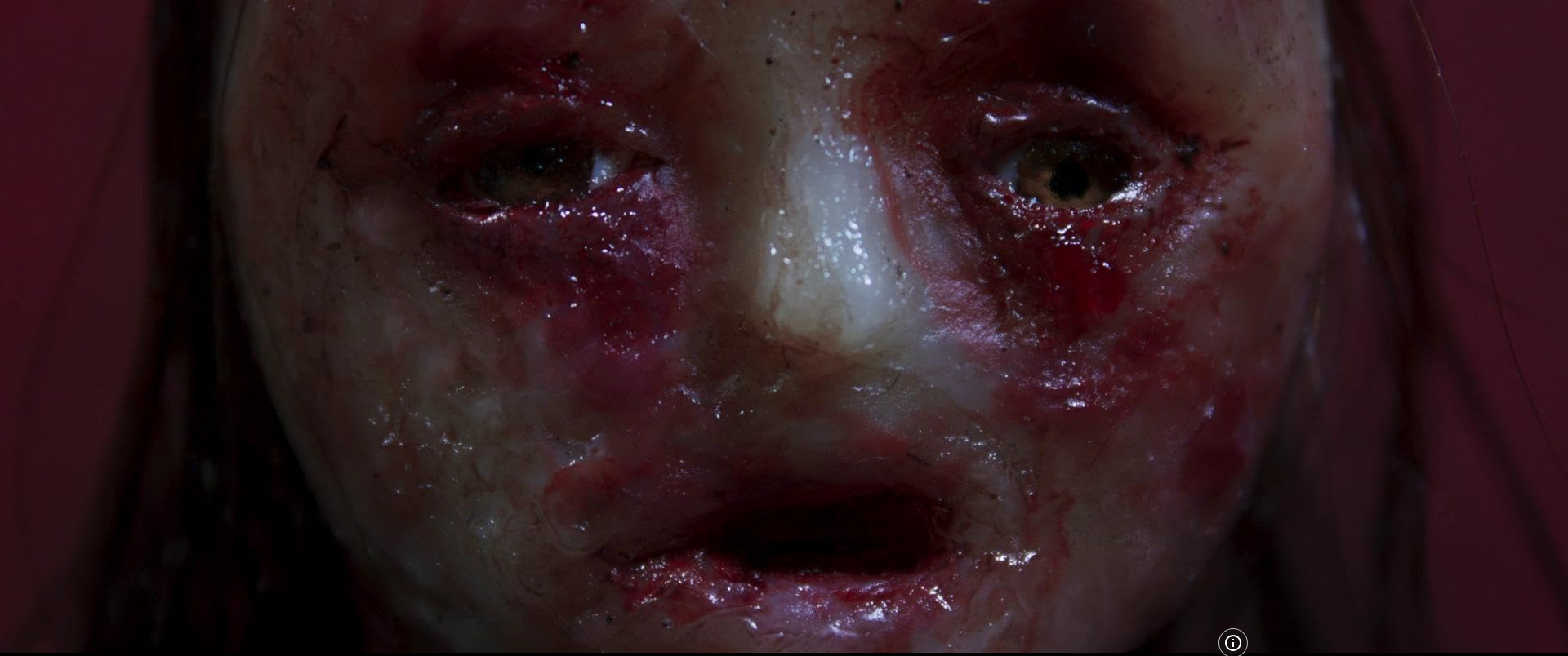 Close-up of a person's face with severe burns and injuries, appearing traumatized and distressed.