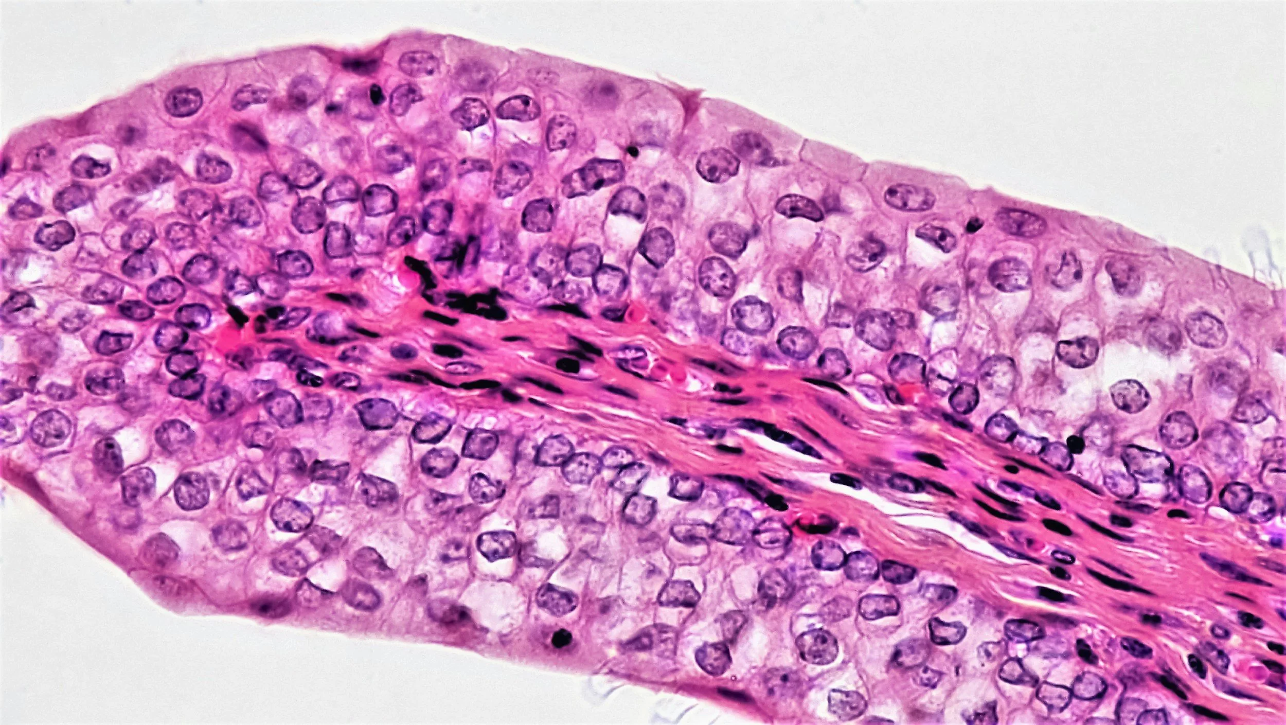 Regenerative medicine company