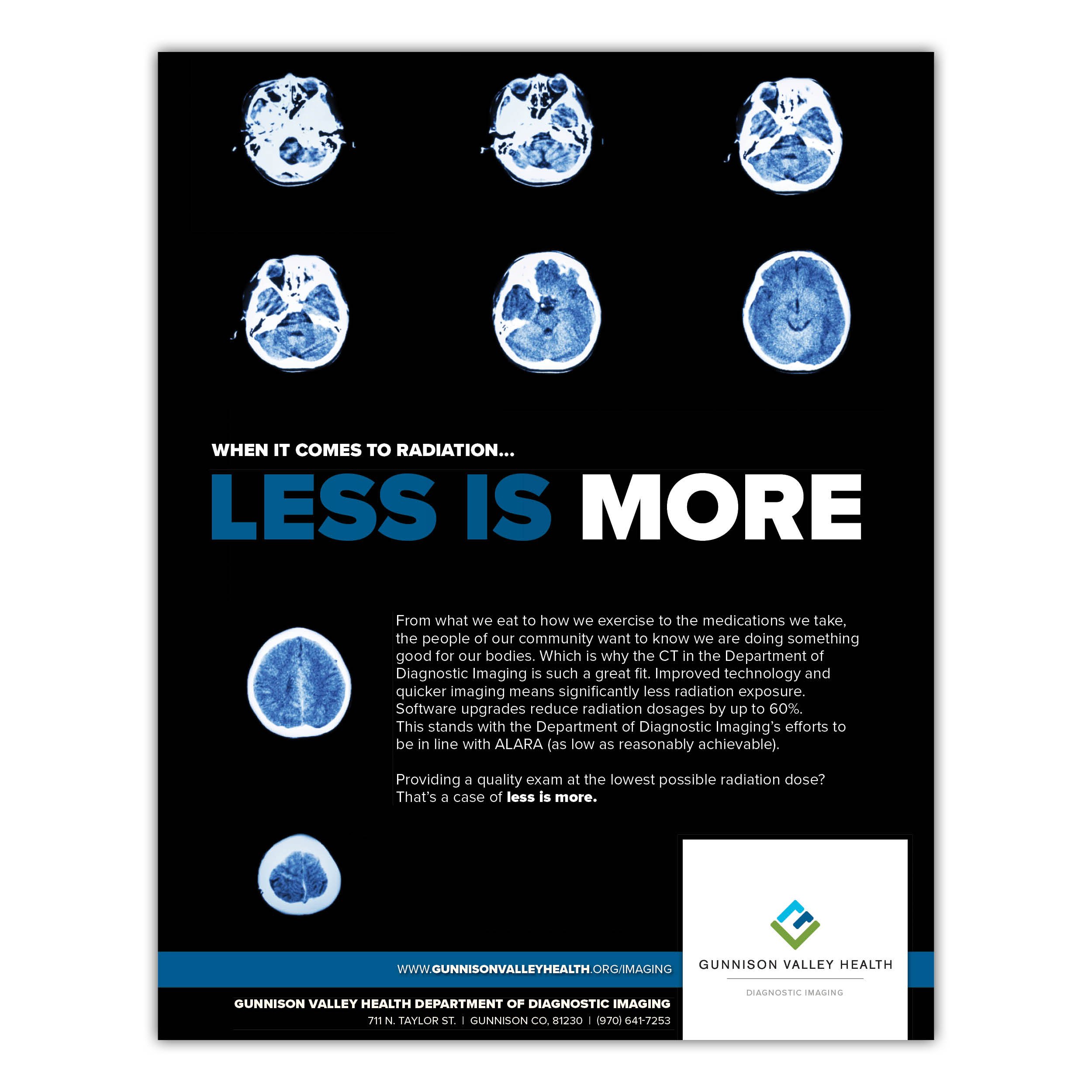A flyer promoting the importance of minimal radiation exposure during medical imaging, featuring black background, blue and white text, and images of brain scans.