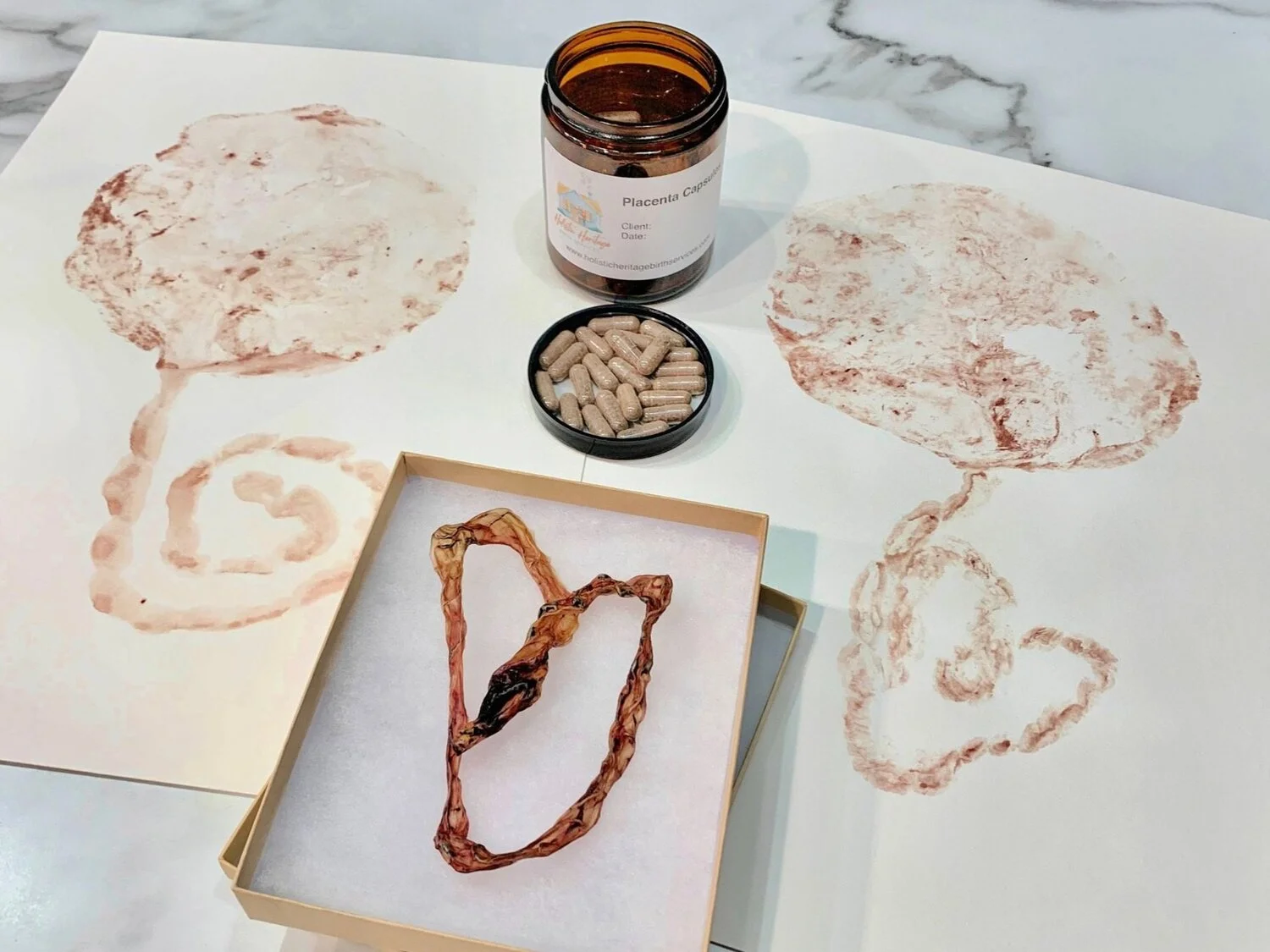 Placenta Encapsulation and Other Holistic Uses for Placenta 
