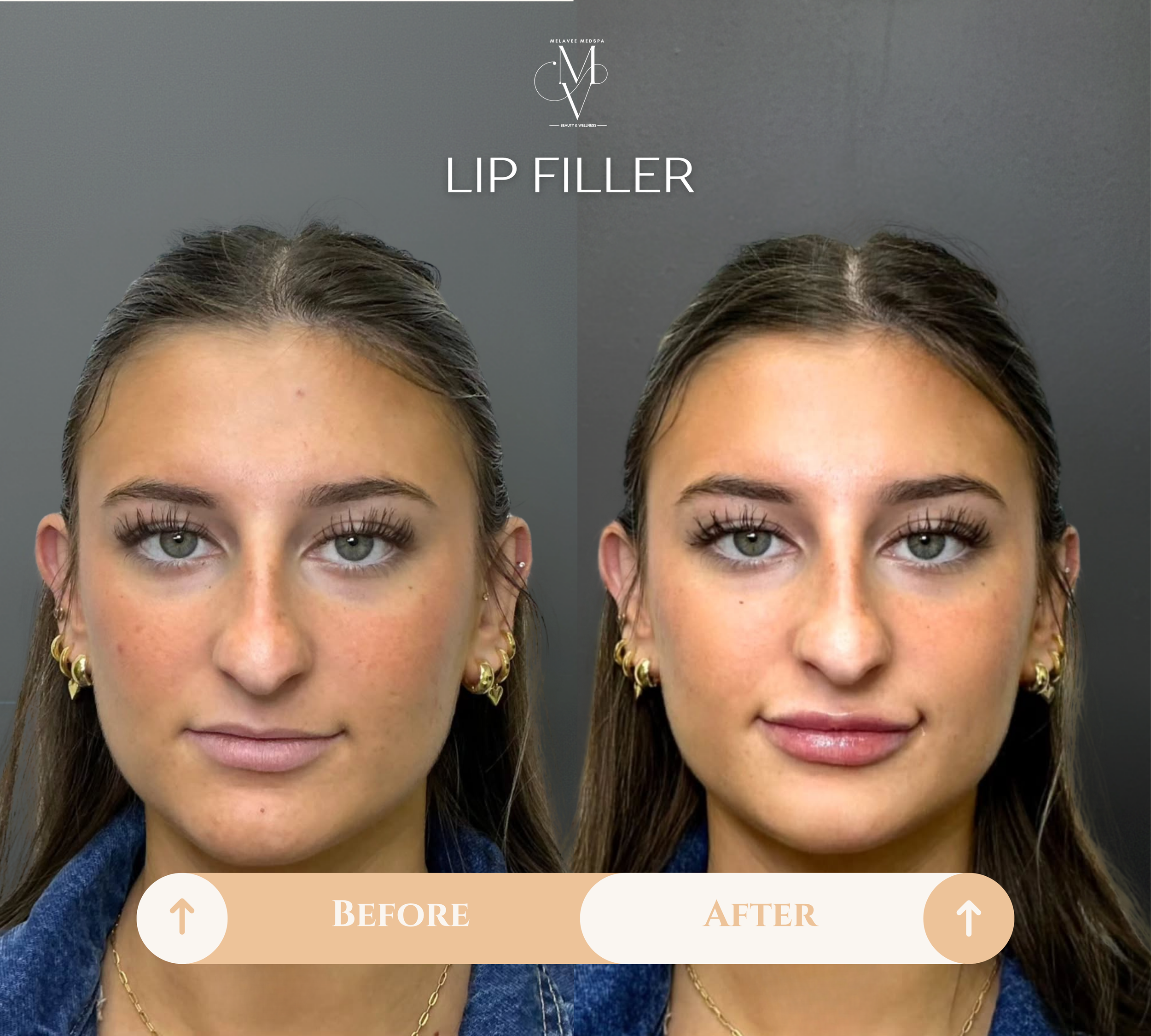 Beige Minimalist Skincare Before and After Instagram Post (2).png