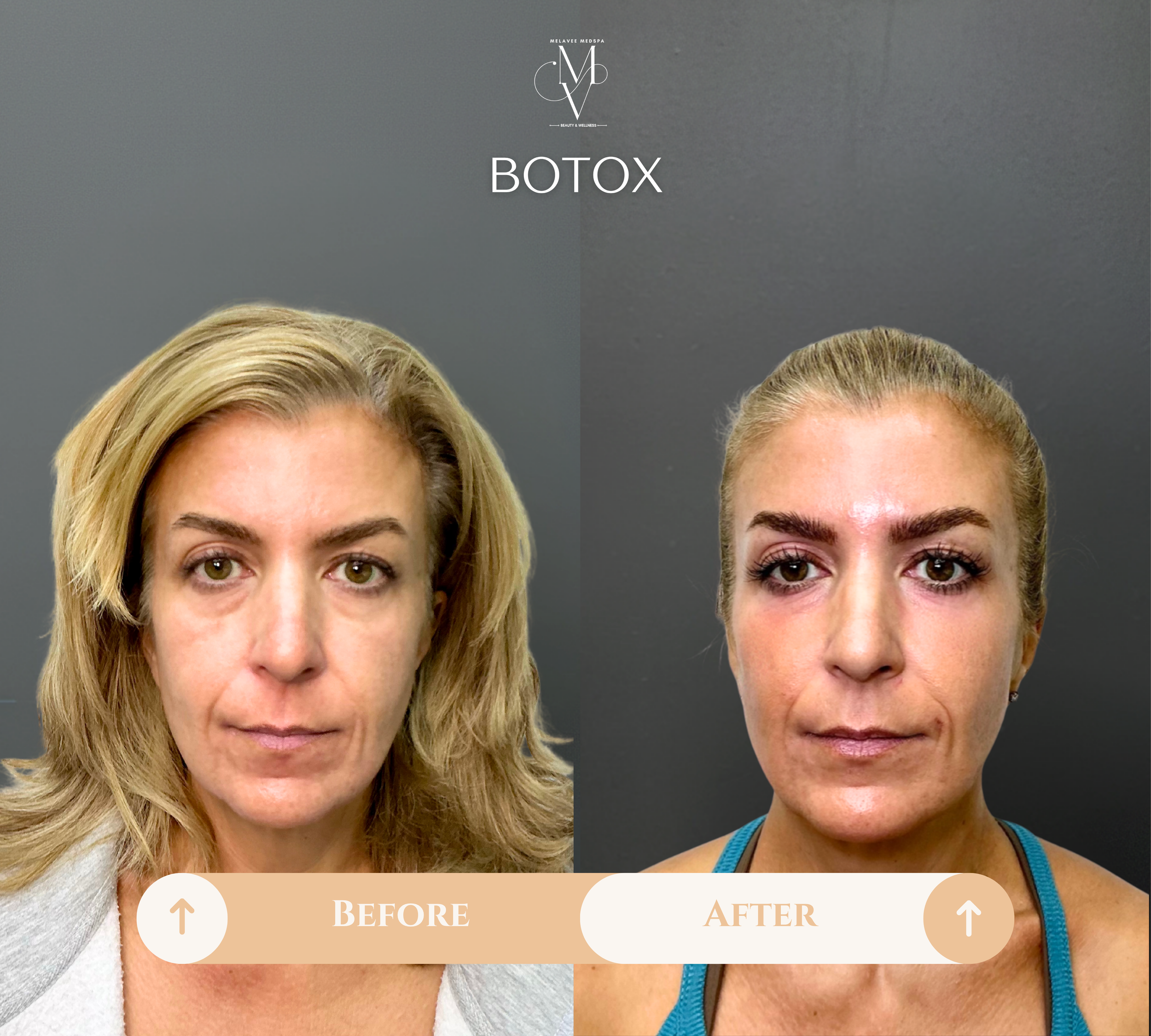 Beige Minimalist Skincare Before and After Instagram Post (1).png