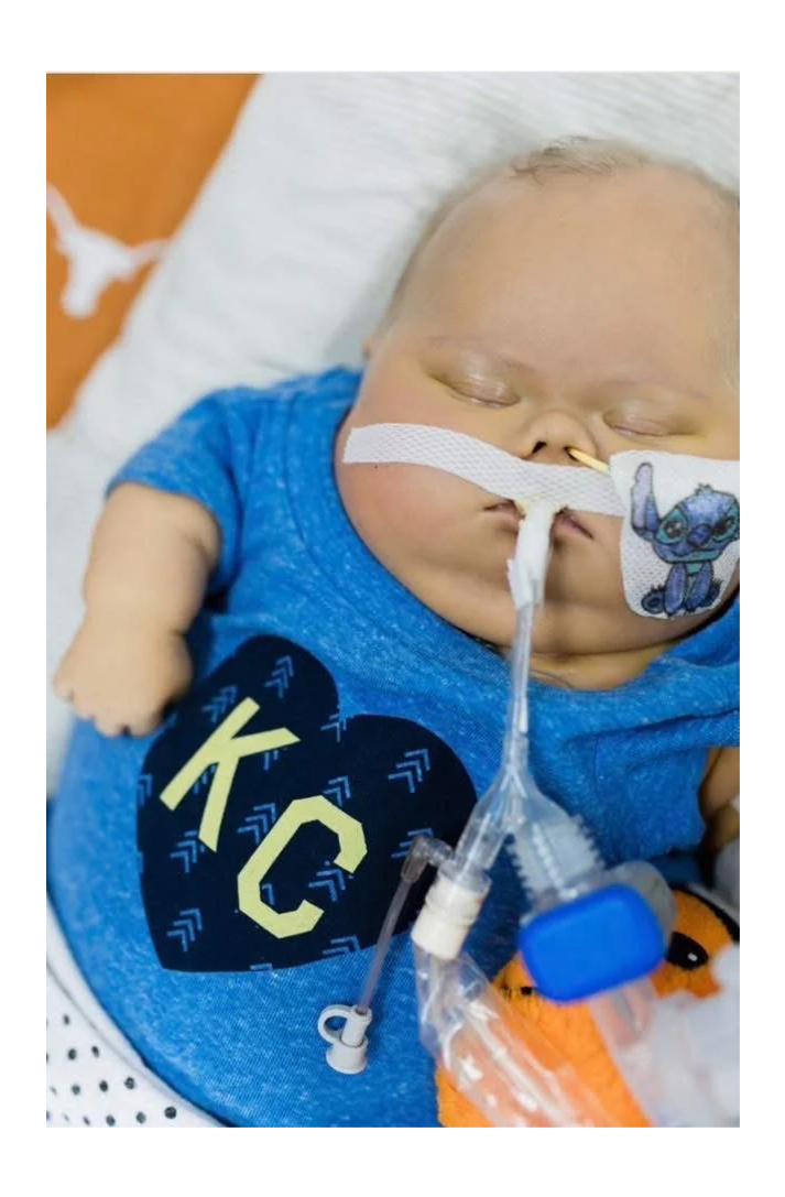 A baby with a nasal oxygen tube, lying on a hospital bed, wearing a blue shirt with a black heart and yellow letters that read 'K C', and surrounded by medical equipment.