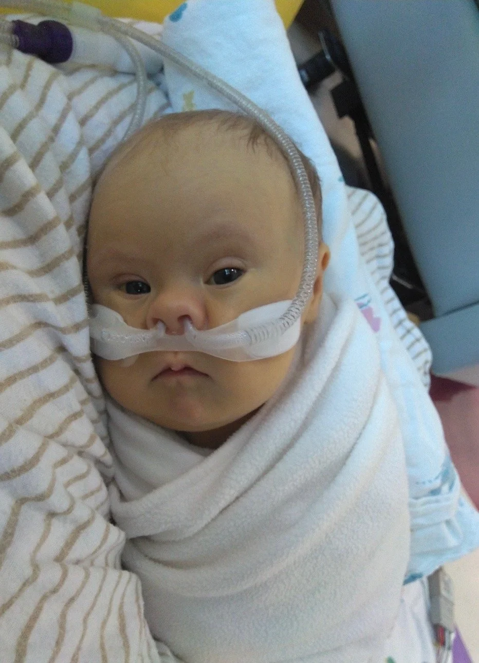 Young baby with nasal oxygen tube wrapped around his face, wrapped in a white blanket, lying in bed with striped bedsheets.