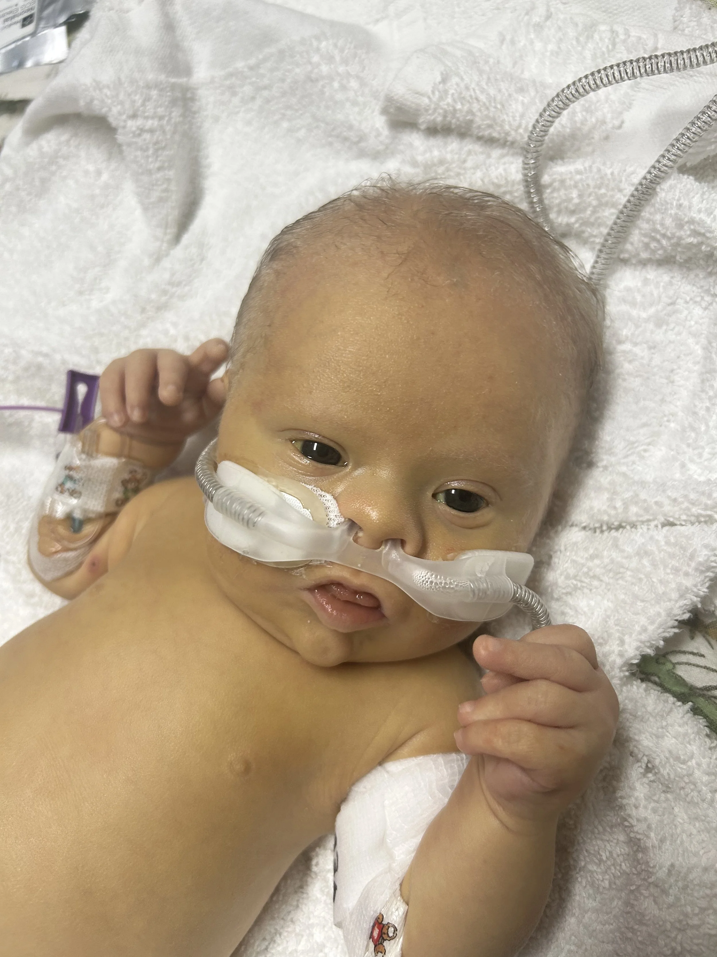 A newborn baby lying on a white towel in a hospital, wearing a nasal cannula and an identification bracelet on the wrist, with a hand resting nearby.
