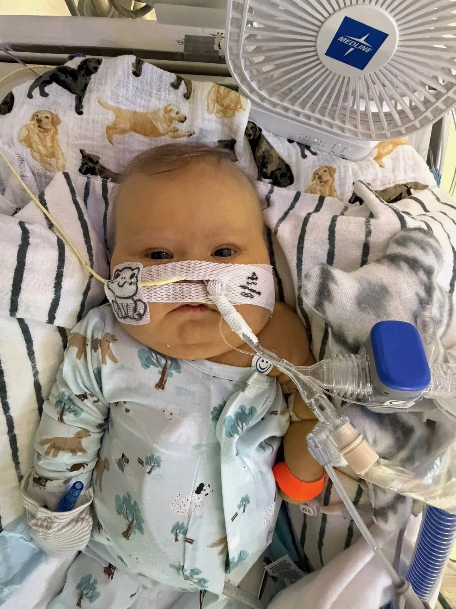 A baby in a hospital bed wearing a hospital gown with animal prints, lying under a blanket. The baby has a nasal cannula and a breathing tube, with medical equipment and a Medline fan nearby.