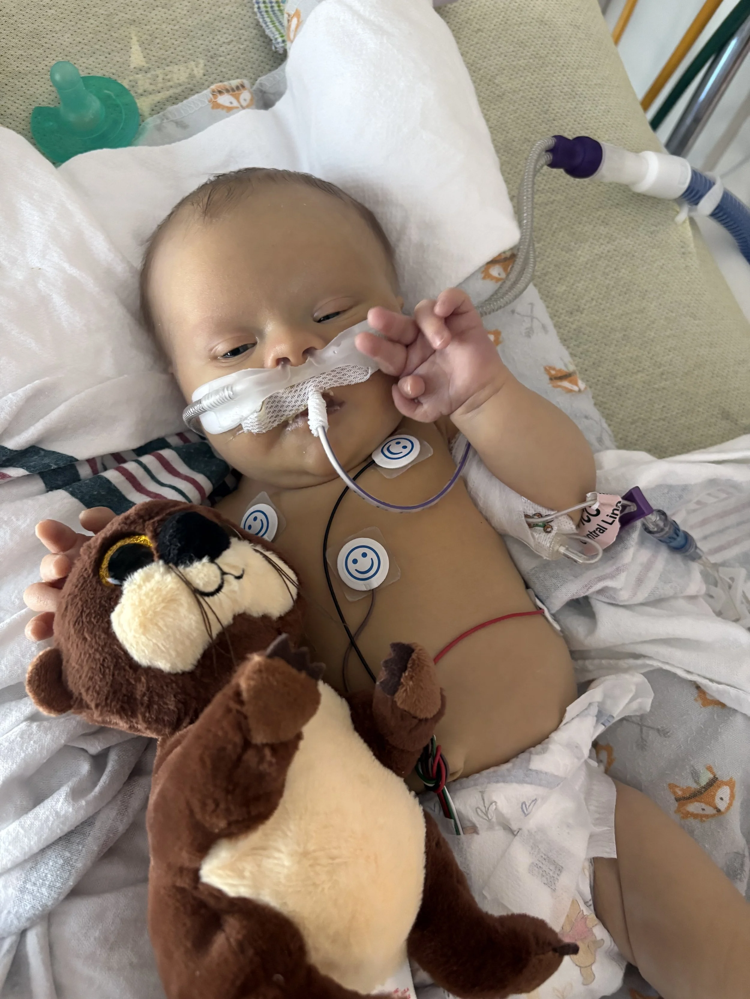 A young child in a hospital bed with a breathing tube, connected to medical equipment, holding a plush lion toy.
