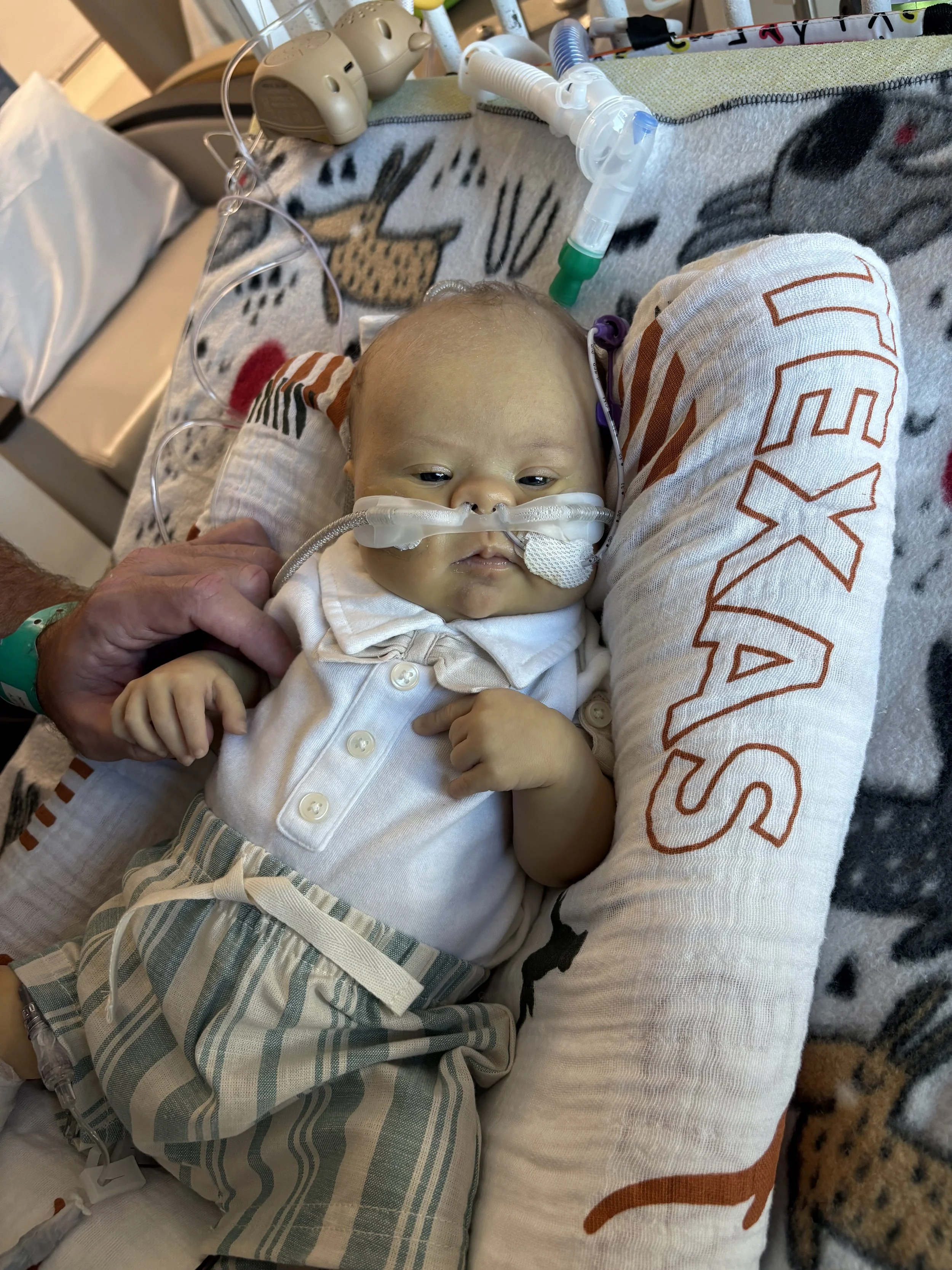 A baby in a hospital bed with medical tubing and equipment, wearing striped pajama bottoms and a white shirt, lying on a blanket with animal and star patterns, with a hand gently holding the baby's arm.