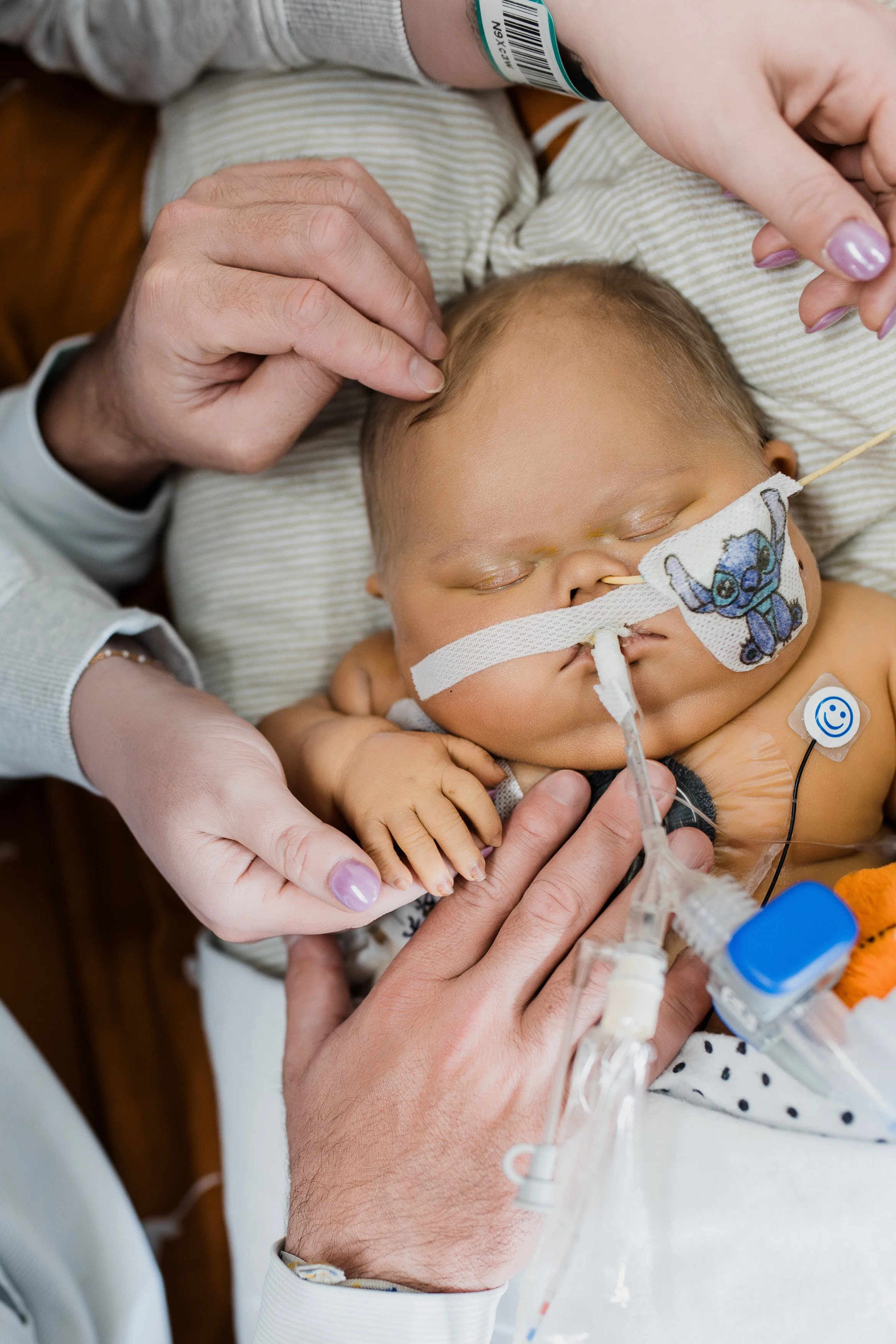 A young child with a medical breathing tube and monitoring sensors in a hospital bed, being gently held and cared for by an adult.