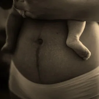 Close-up of a pregnant belly with a fetal hand resting on it.