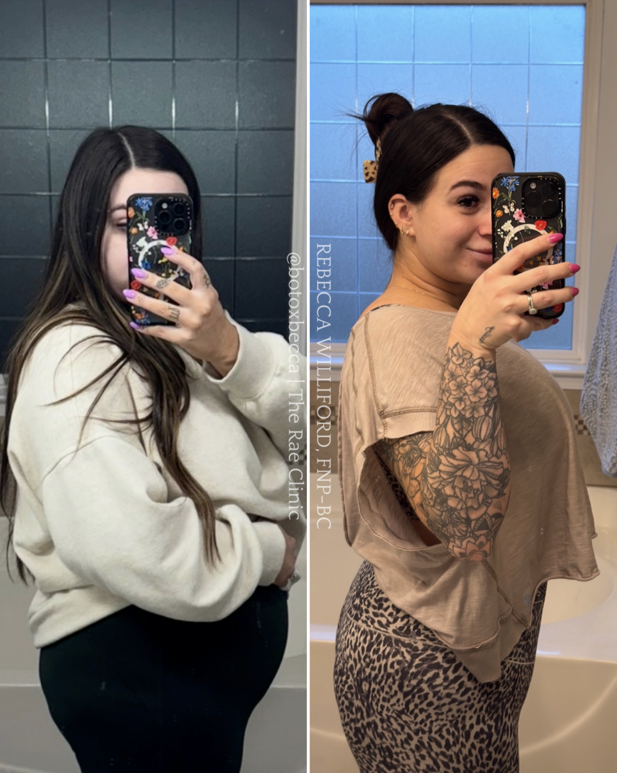 Weight loss before and after weight loss program | Rebecca Williford, FNP-BC | The Rae Clinic | Evans, Augusta, GA