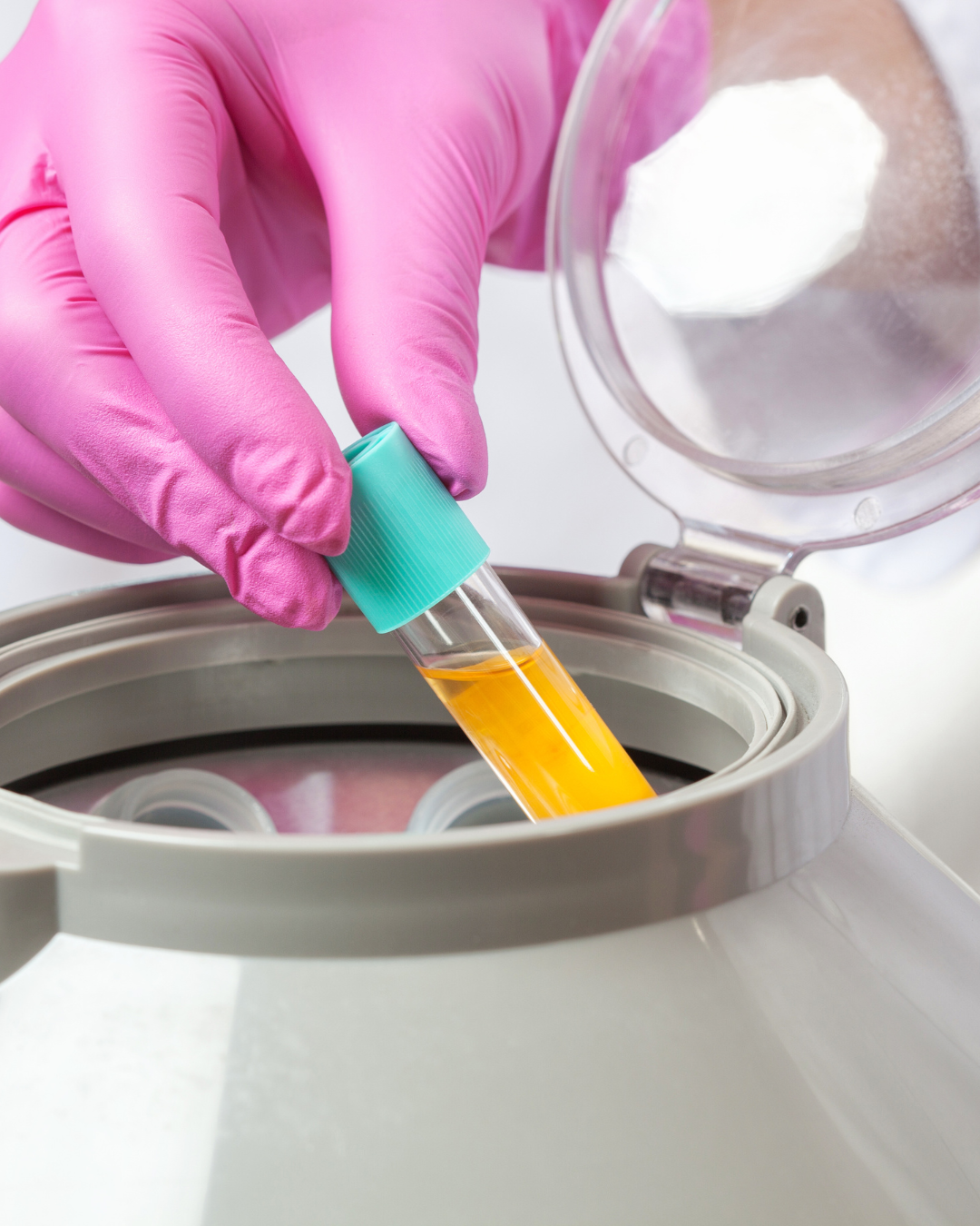 Concentrated PRP platelet-rich plasma drawn for facial treatment | The Rae Clinic in Evans, GA