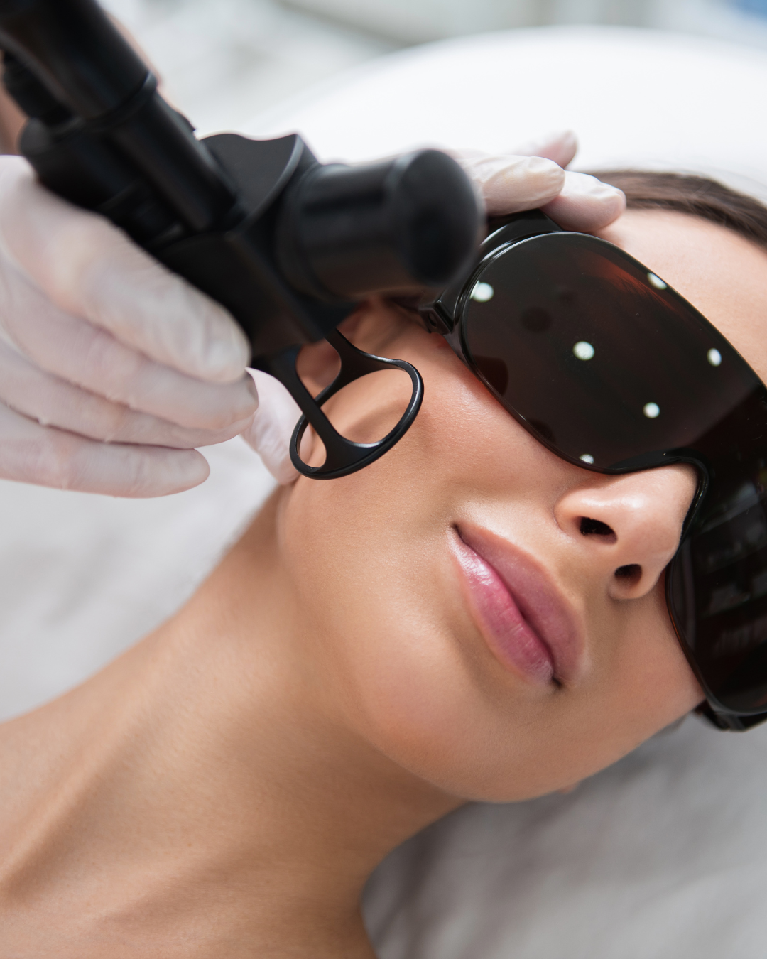 Laser facial treatment being performed on a patient | The Rae Clinic in Evans, Augusta, GA