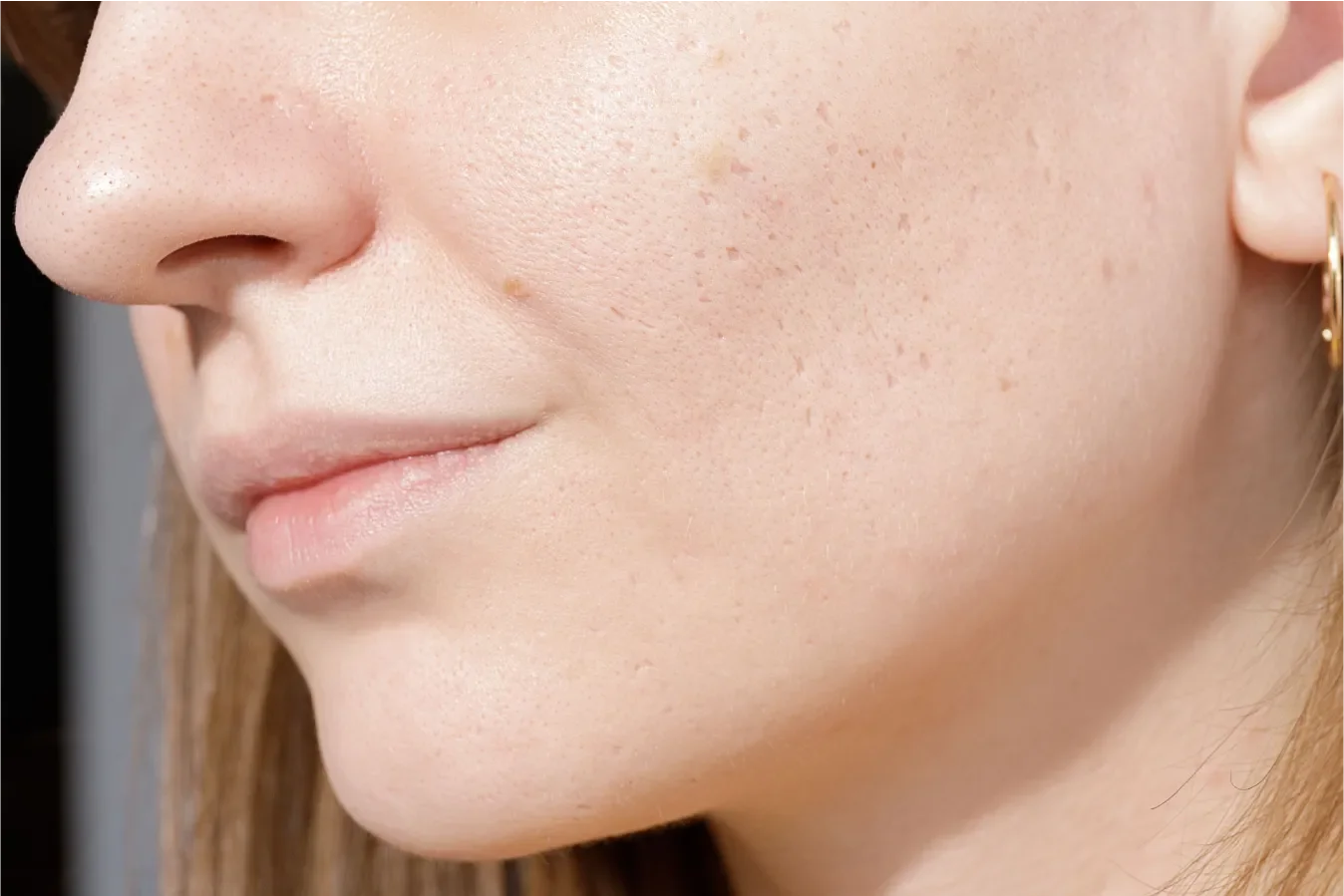 Close-up of a woman's cheek, showcasing her skin texture, pores, and freckles with light makeup and an earring.