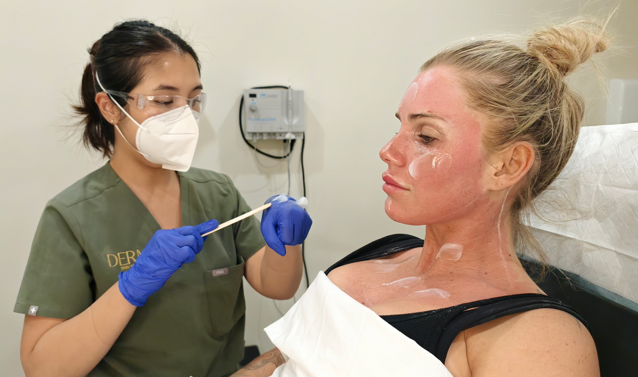 co2 Brisbane Dermatologist
