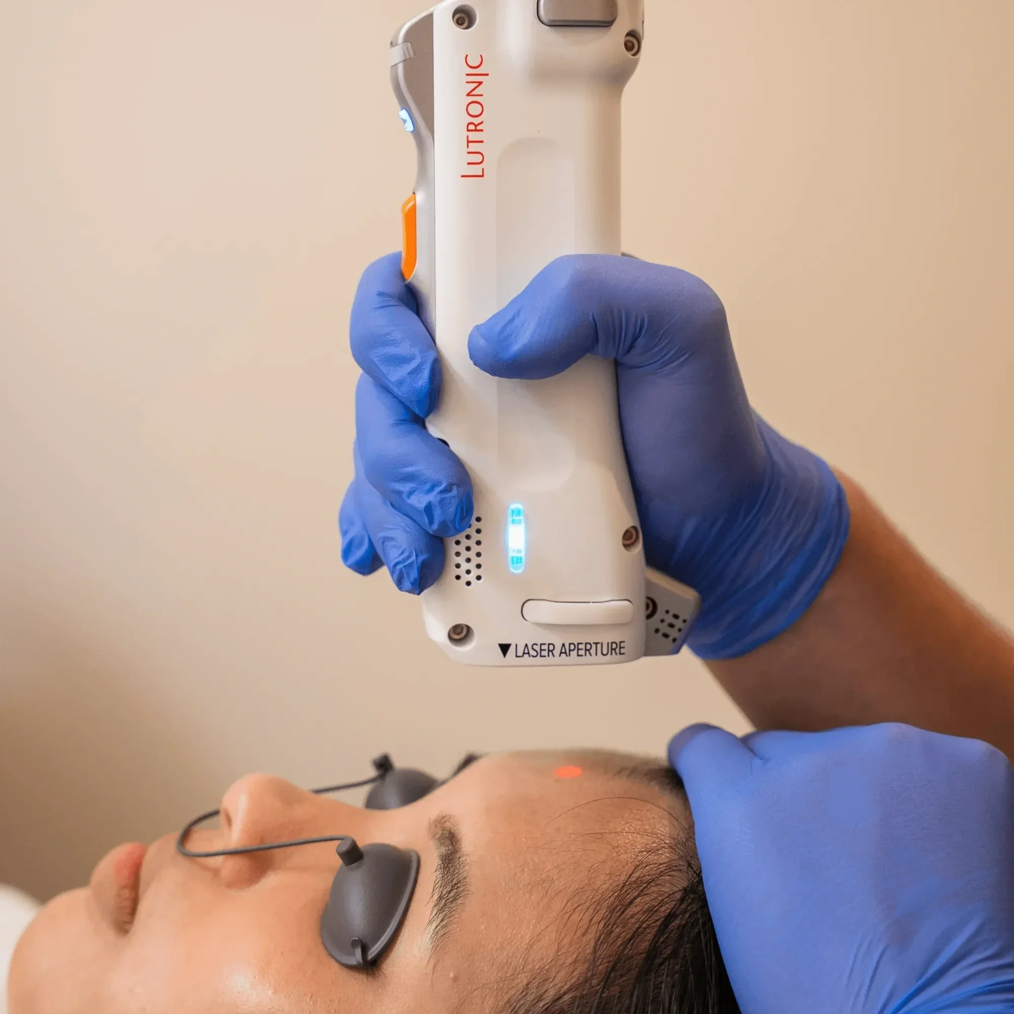 A person lying on their back with an eye covering device on their eye. A healthcare worker, wearing blue gloves, is holding a laser device near the person's eye, likely for a medical procedure.