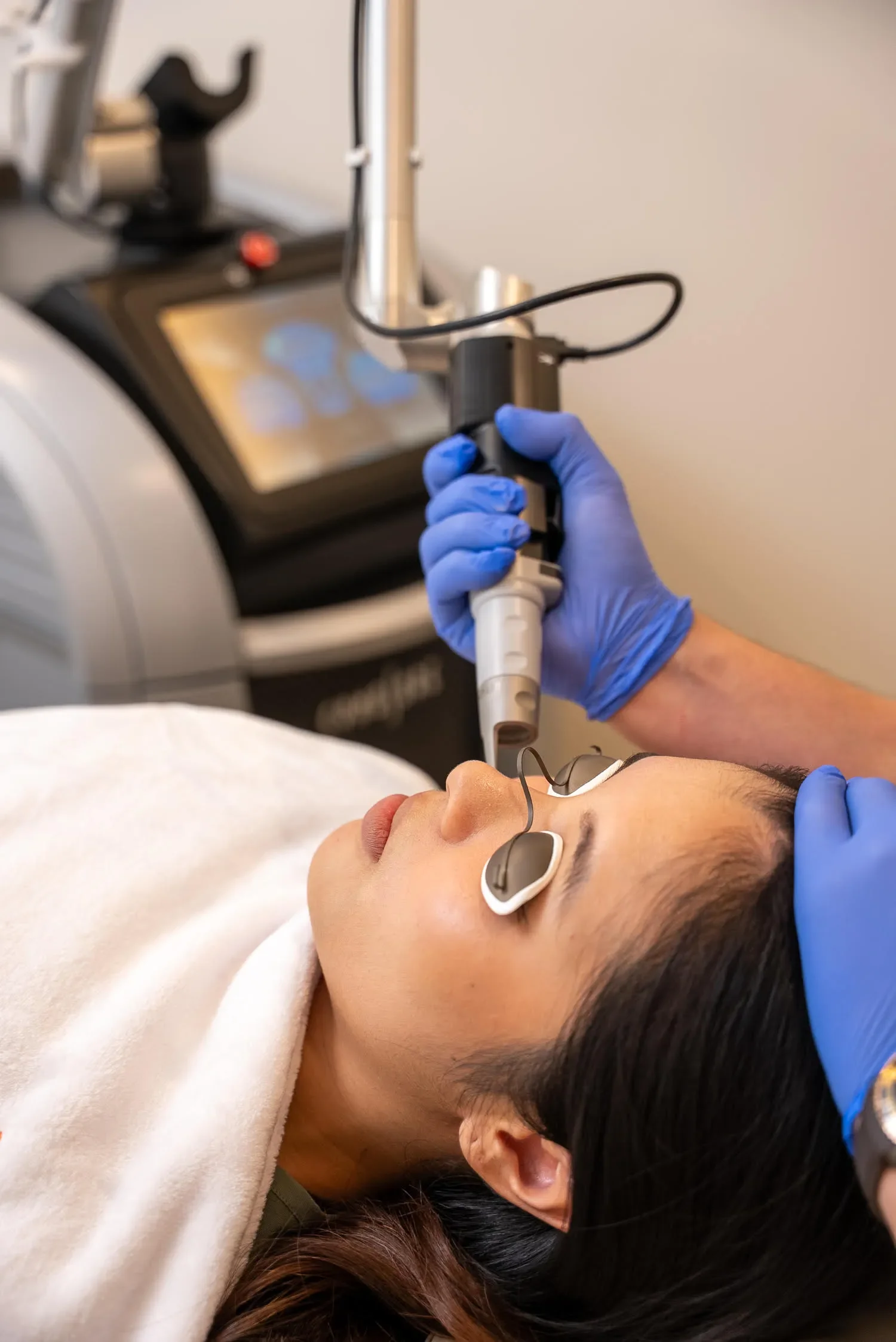 acne scarring treatment