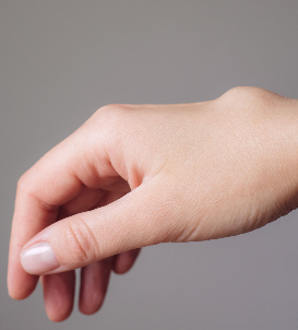Back of the hands treated with fractional CO2 laser for sun damage