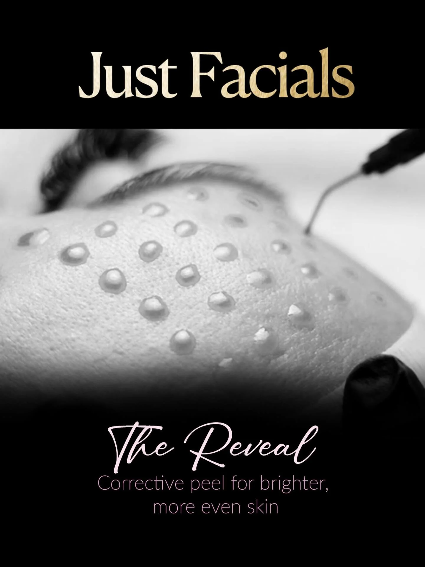 ✨ Introducing The Reveal✨

A no-downtime peel designed for skin that needs a little more than a temporary glow.

Perfect if you want: &bull; smoother, more refined texture  &bull; brighter, more even tone  &bull; softened fine lines  &bull; healthier