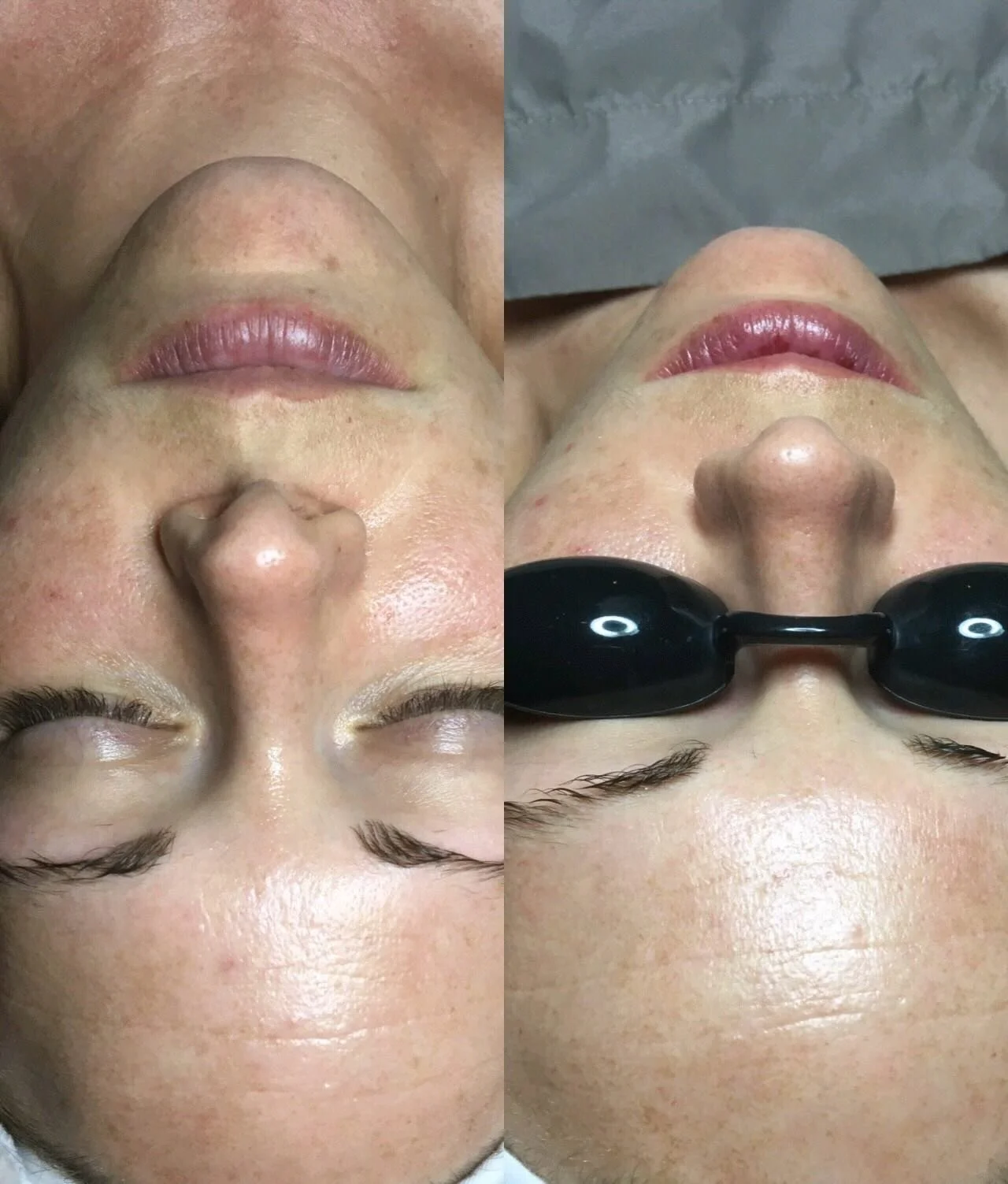 One of the things I love most about dermaplaning is that the results are immediate. ✨🫧

It can sometimes look subtle in photos, but it rarely feels subtle. Most clients notice the difference the moment they touch their skin.

The last slide shows wh